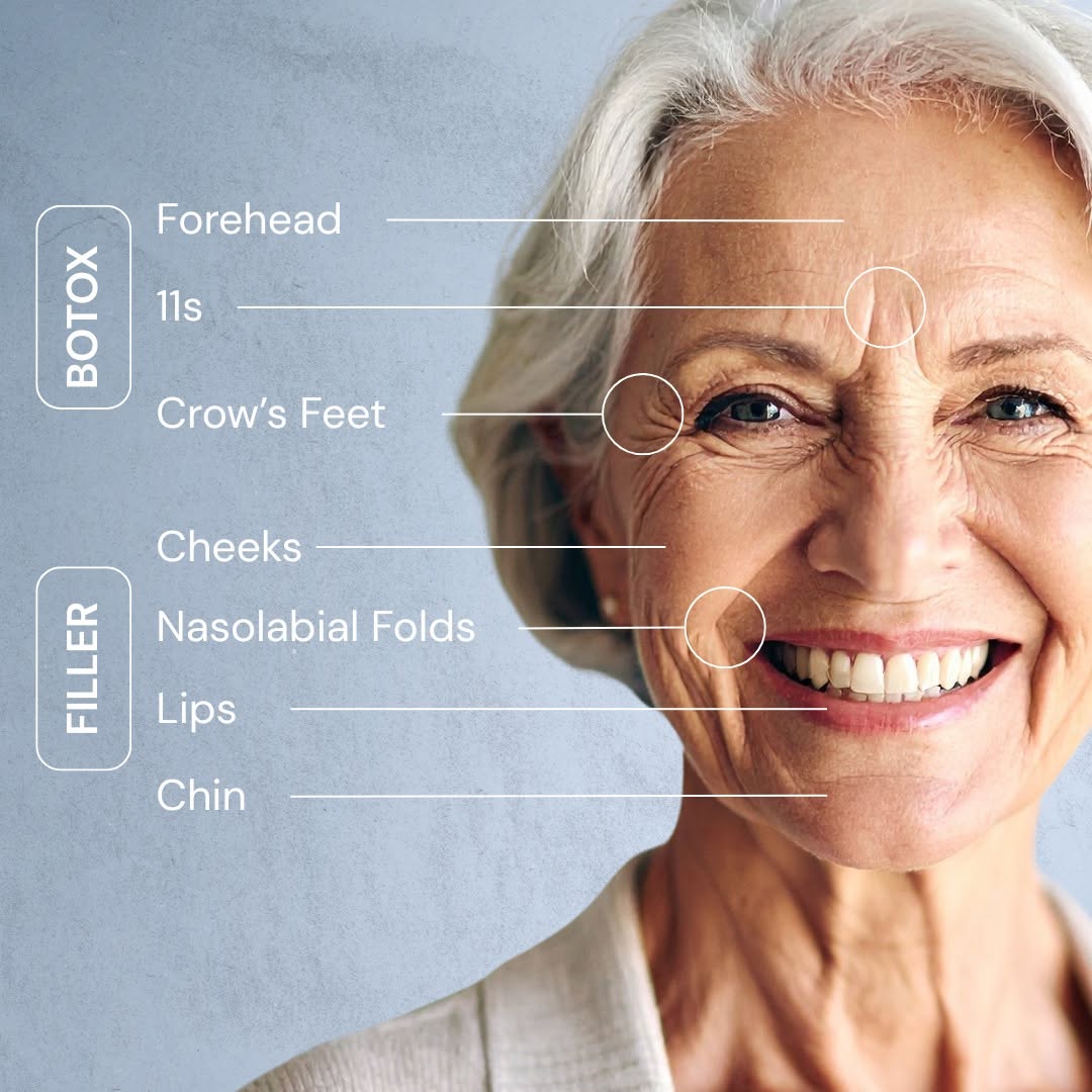 Instagram post by Dr. Margaret Weiss: Filler isn’t just for lips. From restoring volume to enhancing facial balance, filler can treat a wide range of concerns throughout the face…