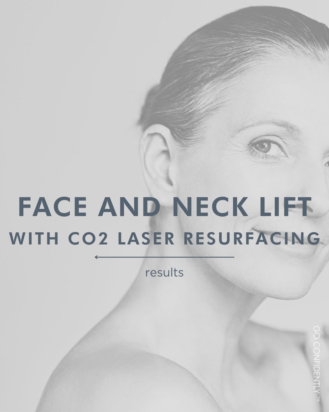 Instagram post by Dr. Marguerite E. Aitken: You—but refreshed, refined, and more confident ✨️⁠ ⁠ This patient’s transformation combined a face and neck lift with ⚡️CO₂ laser resurfacin…