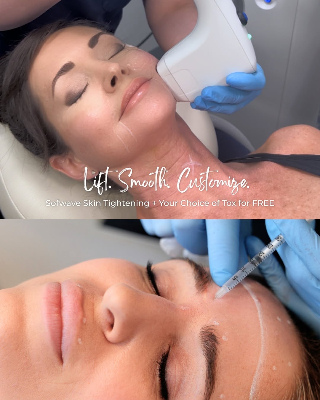 Instagram post by Dr. Maria Atkins, DO: ✨ LIMITED TIME OFFER ✨ Get Sofwave Skin Tightening + Choose Your Tox for FREE!🙌 Customize your treatment: 💎Lift & smooth your face, neck, …