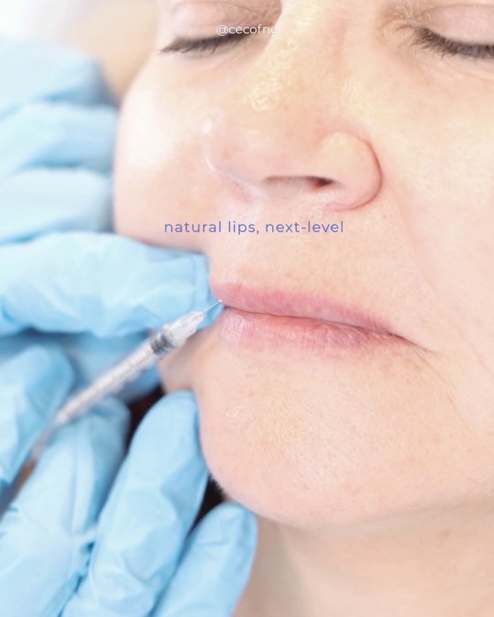 Instagram post by Dr. Maria Atkins, DO: Natural lips. Next level confidence. 💋 Filler doesn’t have to look like filler. Our approach is subtle, balanced, and built around your exi…