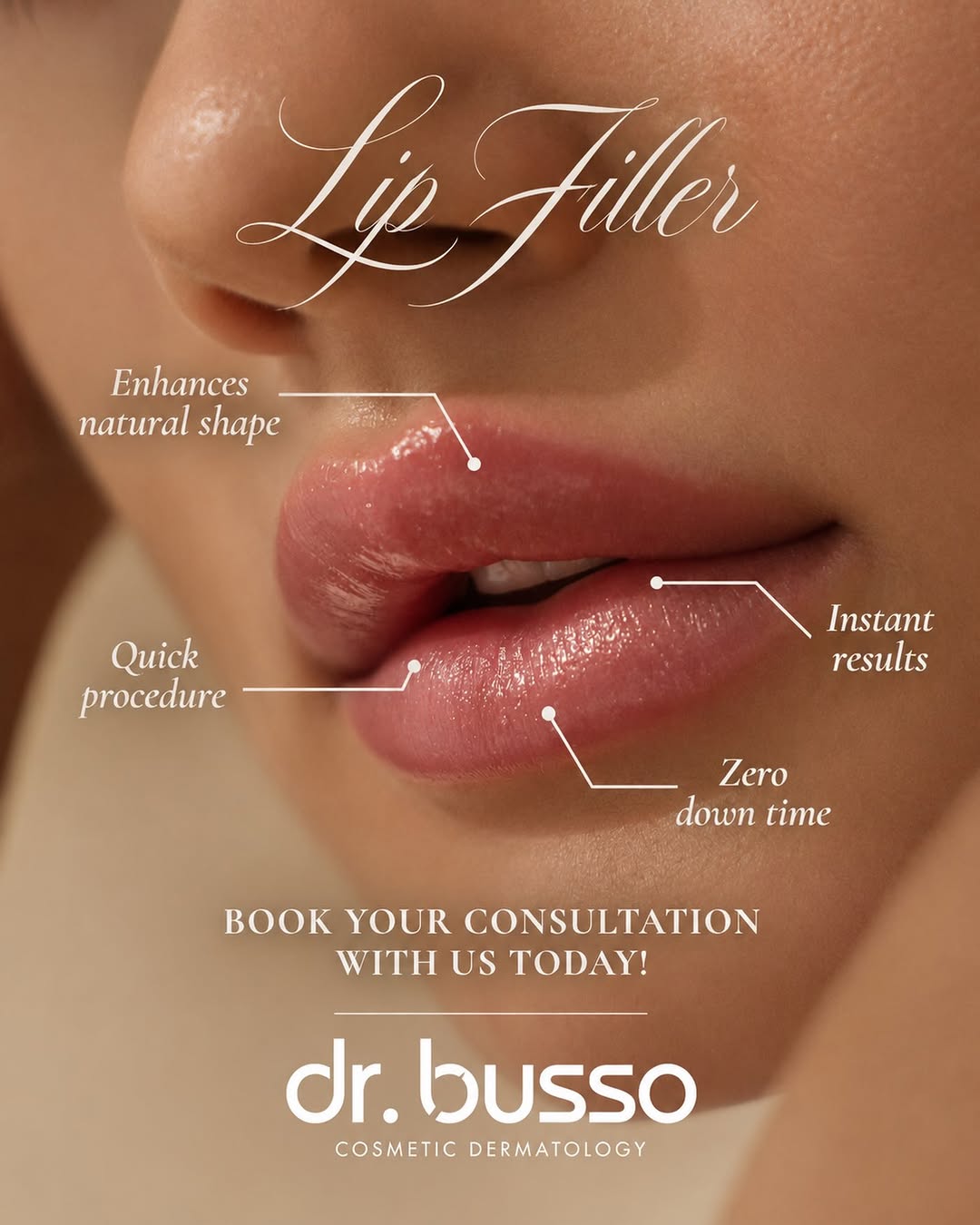 Instagram post by Dr. Mariano Busso: Subtle enhancement, natural results. Lip filler doesn’t have to look overdone, our goal is to enhance your natural shape, restore proportion…
