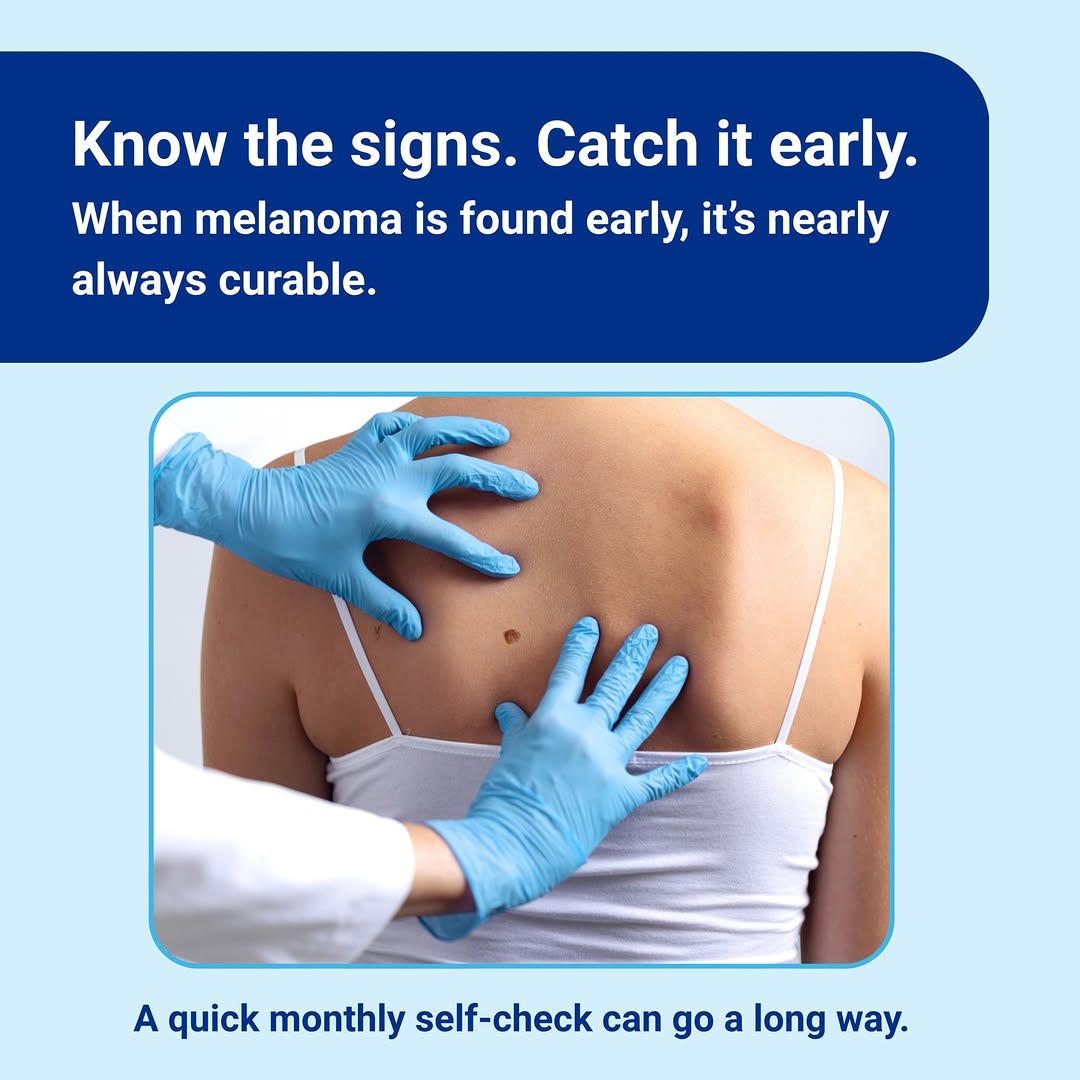 Instagram post by Dr. Marie Anne Giardina-Beckett: It’s Melanoma Monday—and we’re using it to kick off awareness week. When caught early, the survival rate is over 98%. Follow along, share wi…