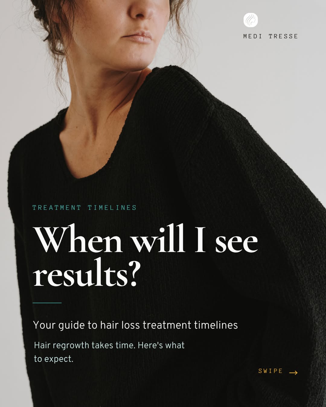 Instagram post by Dr. Mark DiStefano: How long does it take for hair loss treatments to work?⁠ ⁠ Whether you’re starting PRP for hair loss, minoxidil, red light therapy, or hair …