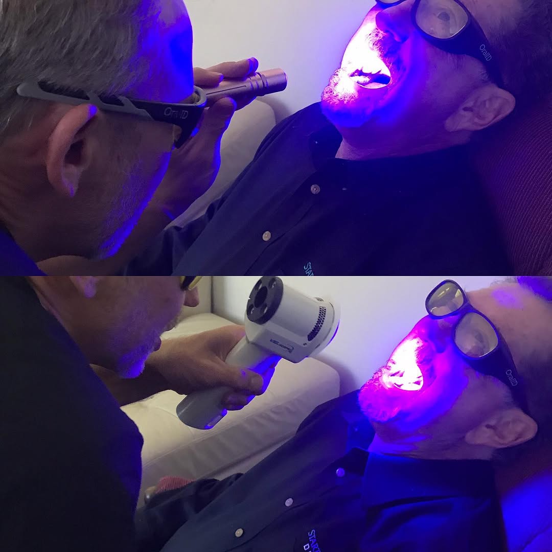Instagram post by Dr. Mark Sayeg, DDS: Comparing Our current Oral Cancer Screening System (Vizilite) to OralID - to make sure we are proving our patients with the most reliable te…