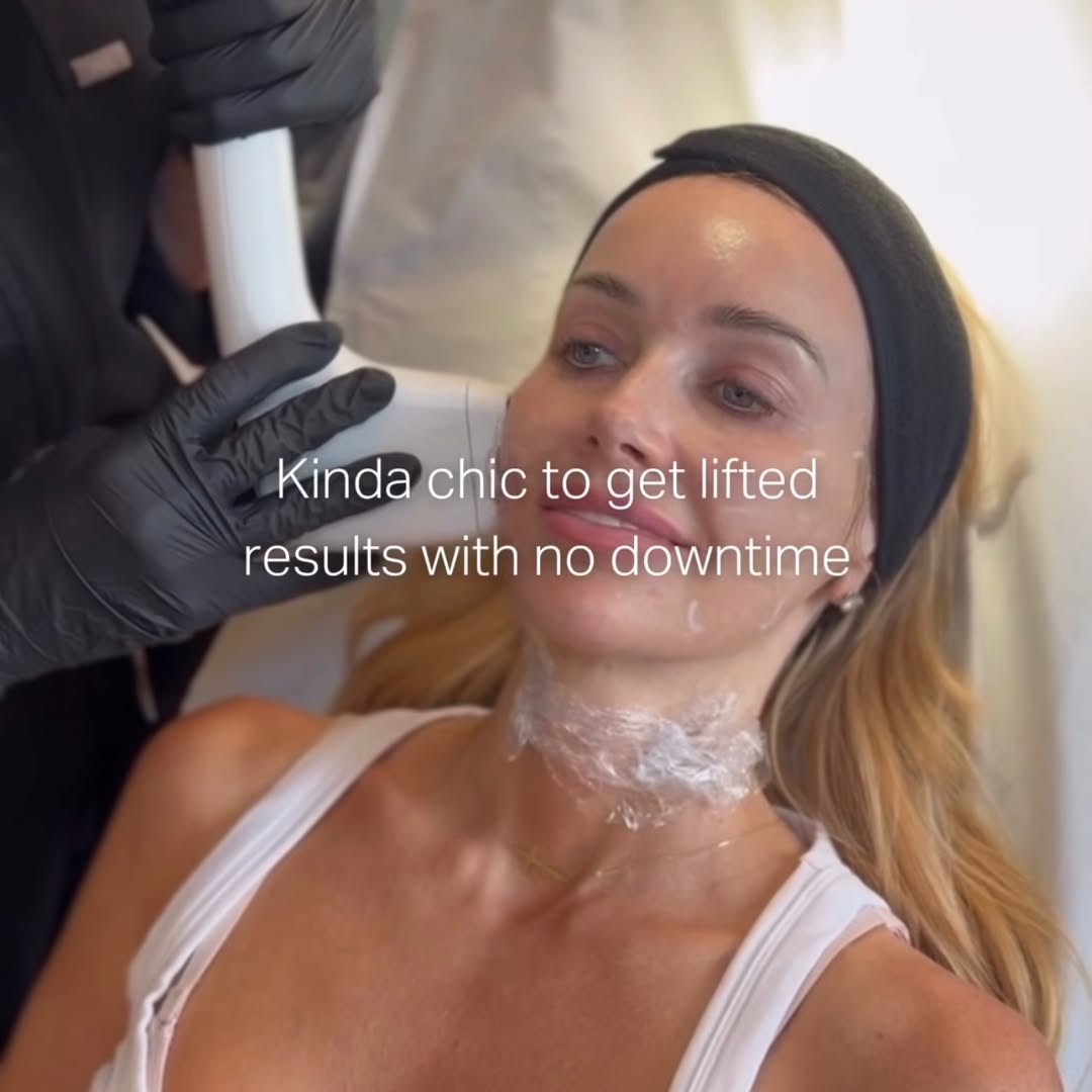 Instagram post by Dr. Mark Sofonio: Lifted, tighter, refreshed ✨ Sofwave™ uses advanced ultrasound technology to help stimulate collagen for firmer, smoother-looking skin with …