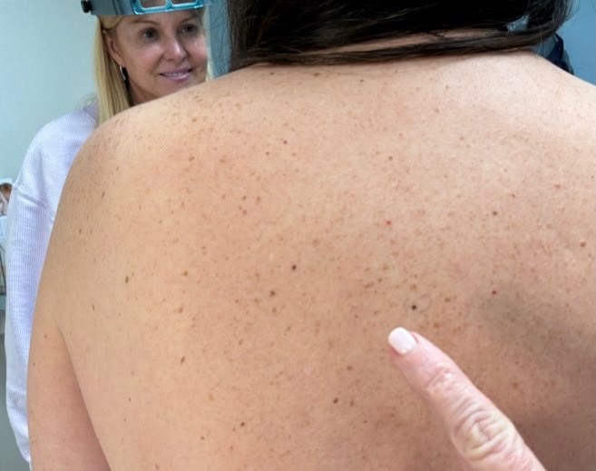Instagram post by Dr. Mary M. Dobson: Here’s your friendly reminder to schedule your next skin check. ✅ Most skin spots are completely harmless, but regular exams help us keep an…
