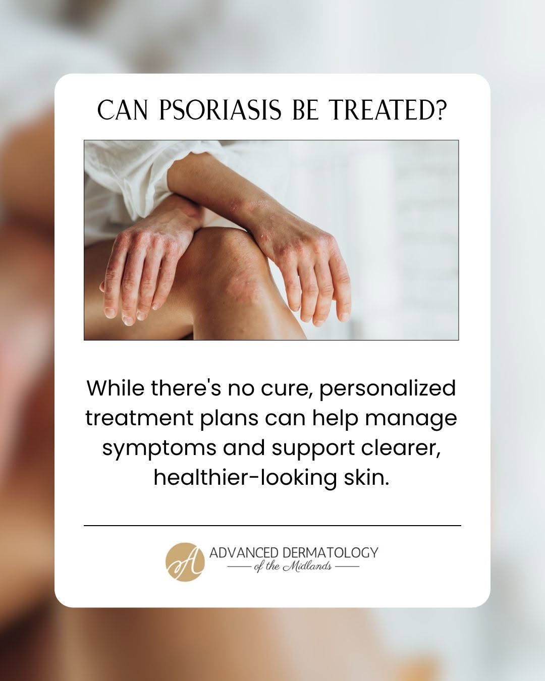 Instagram post by Dr. Mathew A. Davey: Psoriasis is so much more than just a surface-level skin issue. 🩺🤍 It is a chronic autoimmune condition where skin cells build up rapidly,…