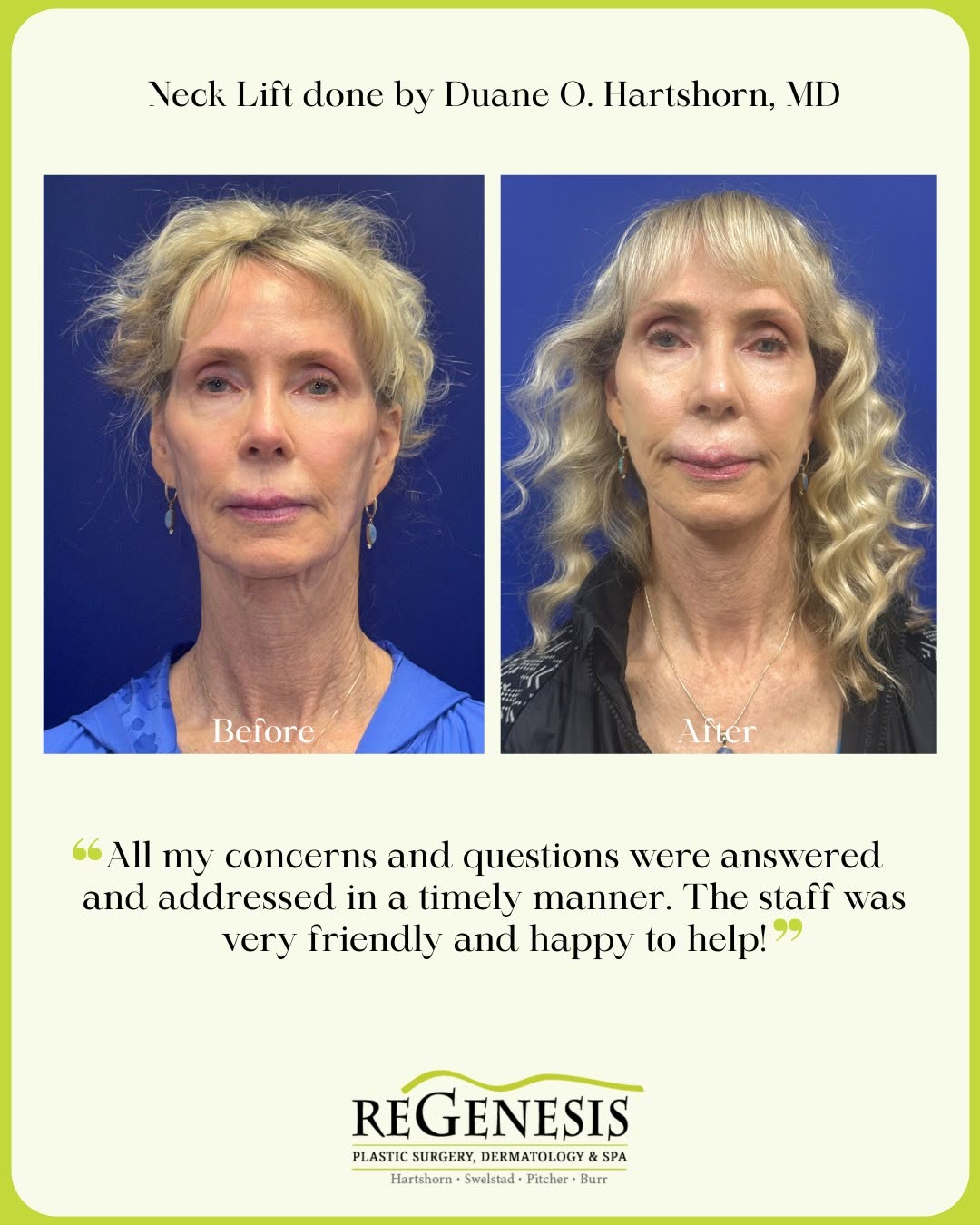 Instagram post by Dr. Matthew Swelstad: Before ➡️ After This patient was very pleased with her results! Her neck lift looked amazing when she came in for her check in. We are so ha…