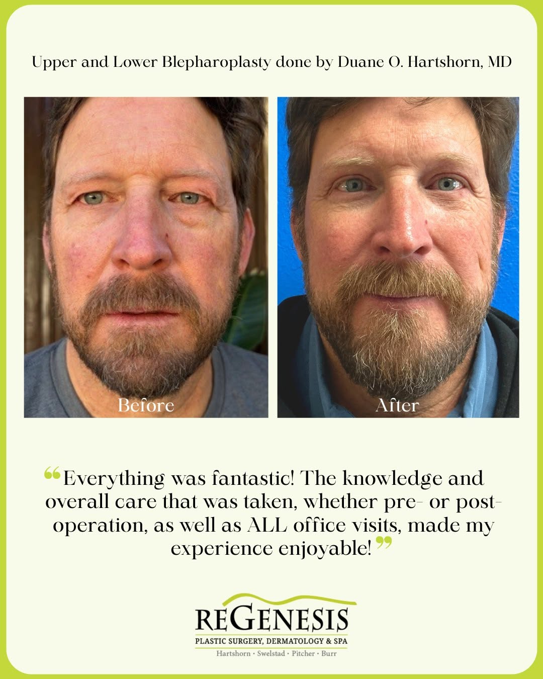 Instagram post by Dr. Matthew Swelstad: Before➡After This patient expressed how amazing our staff is no matter the appointment! Every aspect of the experience was enjoyable! We are…