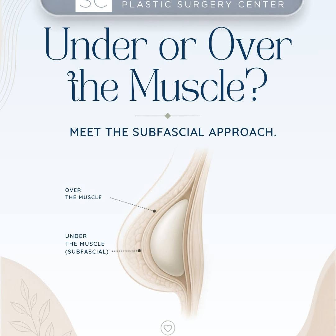 Instagram post by Dr. Mauricio J. Castellon: When planning a breast augmentation with Board Certified Plastic Surgeon Dr. Mauricio J. Castellon, the placement of your implant is one of …