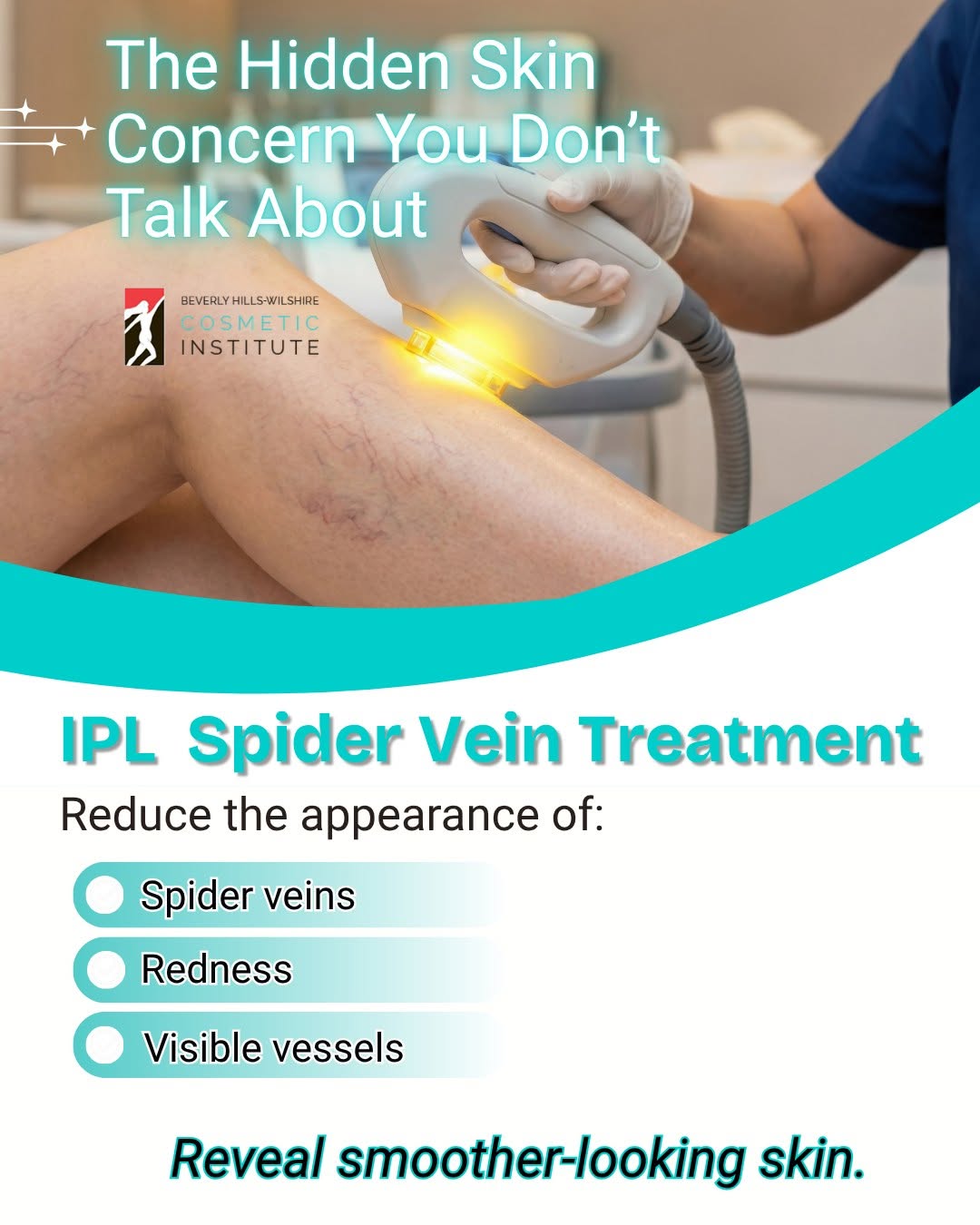 Instagram post by Dr. Mehrdad Hassid: ❤️ Spider veins and visible redness can be more noticeable than you’d like, but you don’t have to simply live with them. IPL (Intense Pulsed…