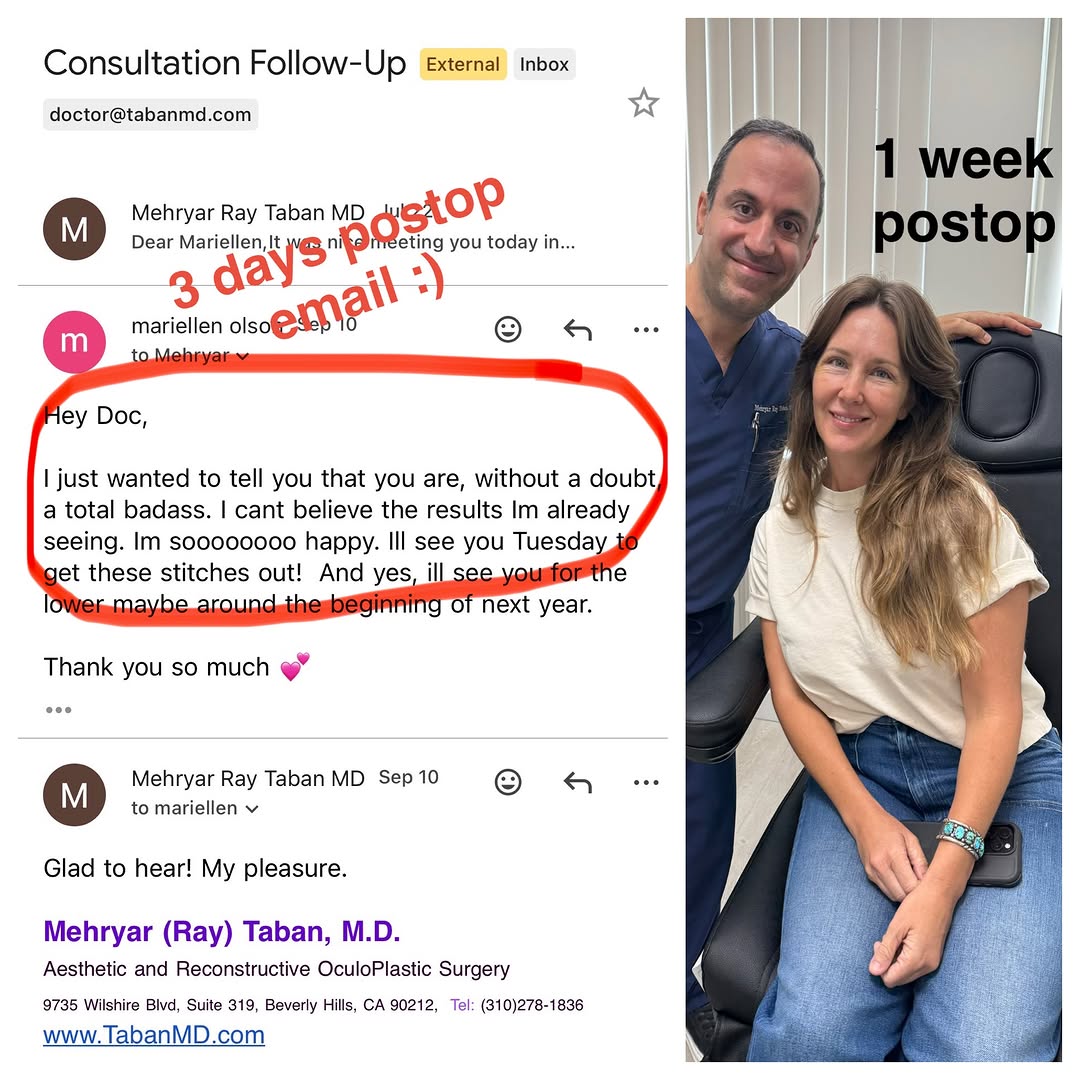 Instagram post by Dr. Mehryar (Ray) Taban: #eyesbytaban 3 days postop email note from my patient followed by her 7 days postop visit after customized #upperblepharoplasty . With minim…