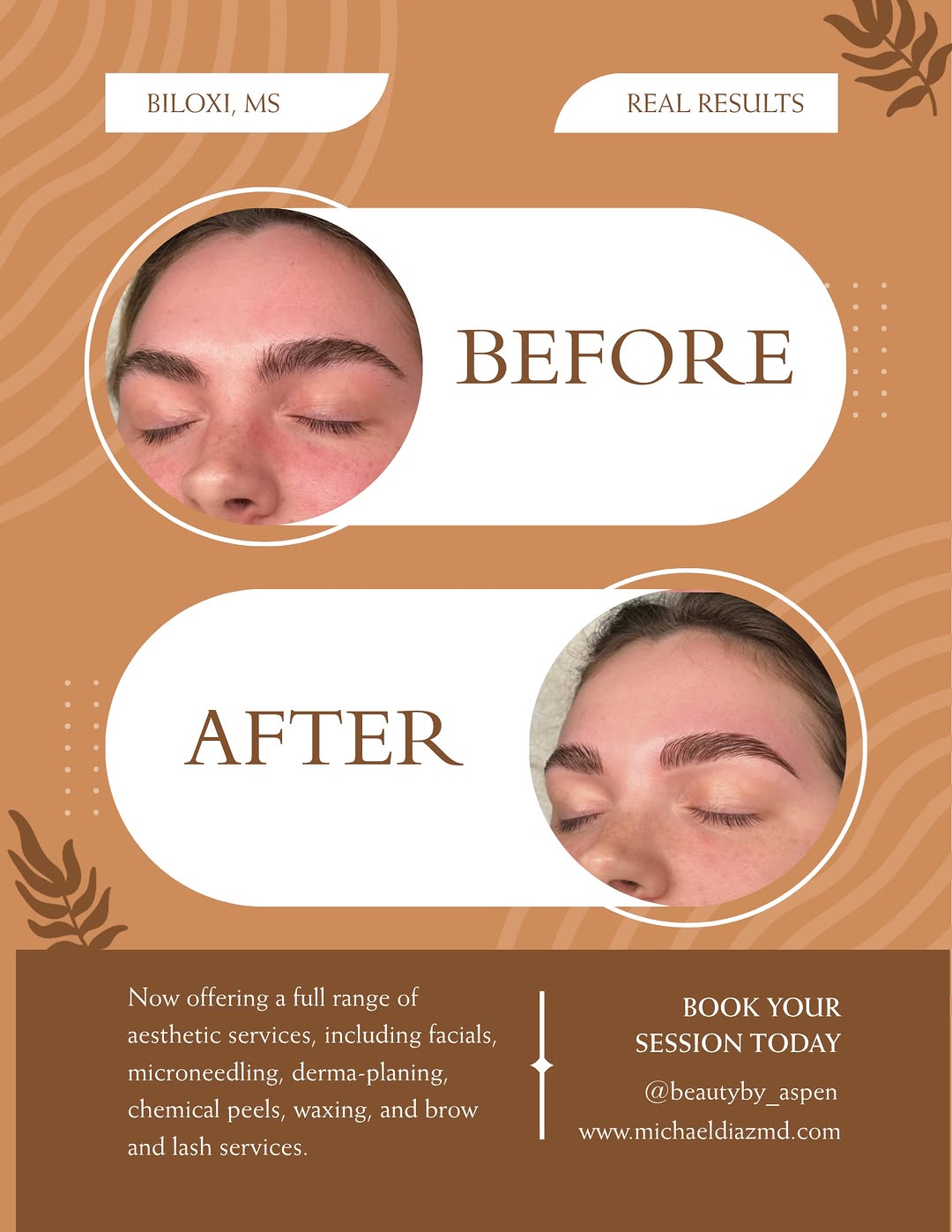 Instagram post by Dr. Michael Diaz: 🚨 Check out these before & after photos! 🚨 Book all your aesthetic services today! 💆🏽 💻 michaeldiazmd.com 📲228-396-2663 📍Biloxi, MS