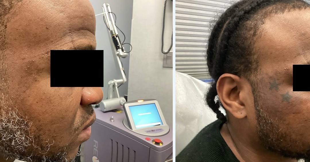 Instagram post by Dr. Michael Ehrenreich: Thinking of removing that old tattoo? At SOMA Skin & Laser, our advanced laser tattoo removal technology helps fade unwanted ink safely and …