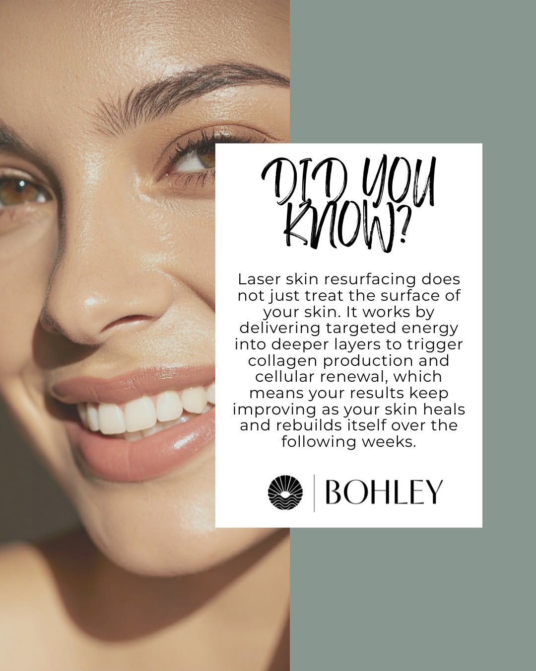 Instagram post by Dr. Michael F. Bohley: Did you know? Laser skin resurfacing does not just treat the surface of your skin. It works by delivering targeted energy into deeper layers…