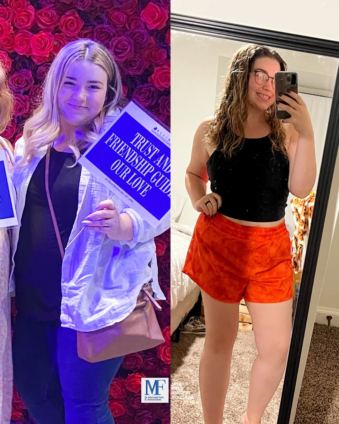 Instagram post by Dr. Michael Feiz: This before and after represents commitment, consistency, and a completely new chapter. Weight loss surgery can be a powerful tool for the r…