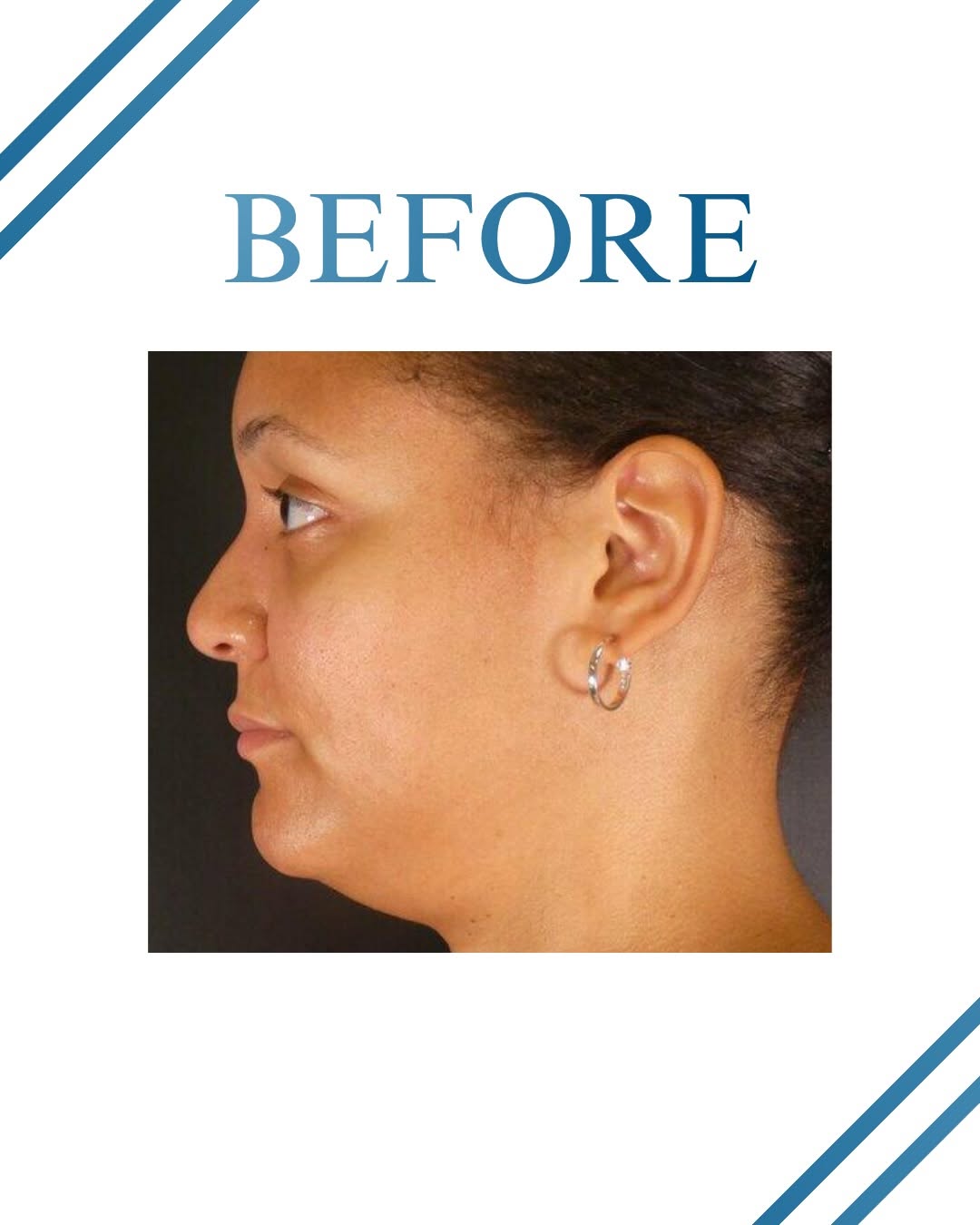 Instagram post by Dr. Michael Horn: Results like this come from planning, not luck. #aesthetics #cosmetics #beforeandafter #doctor #results
