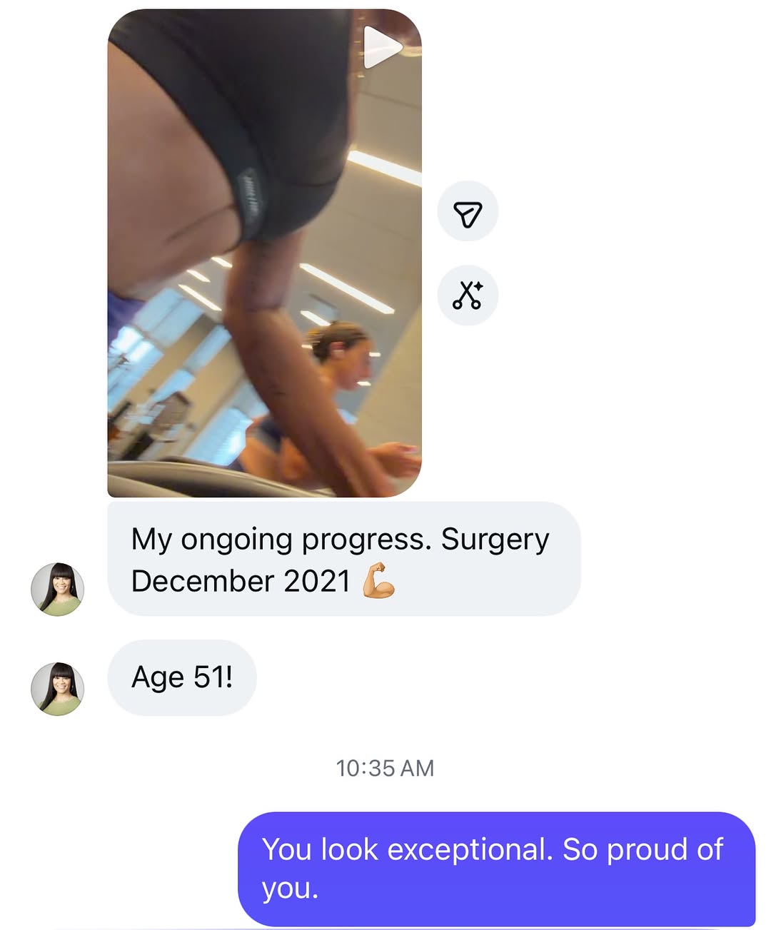 Instagram post by Dr. Michael J. Stein: 5 years after her tummy tuck and thriving!!!!! So proud of our amazing patient!!