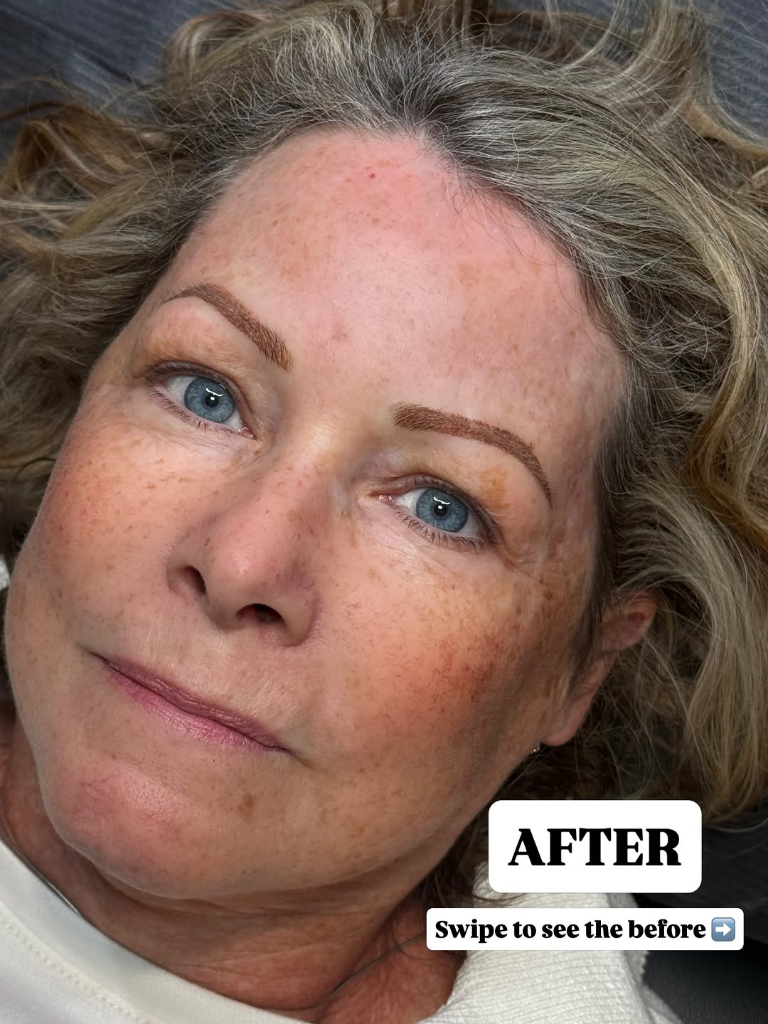 Instagram post by Dr. Michael Orseck: Brows that make a difference ✨ Soft, natural-looking nano brows customized just for her. Swipe to see the before ➡️ #greenville #greenvilles…