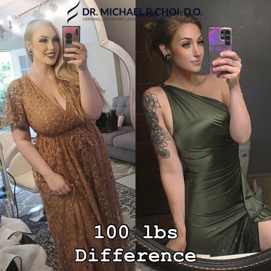 Instagram post by Dr. Michael P. Choi: #gastricsleevesurgery #drchoipeptides #wellness #wls #dr_michael_choi