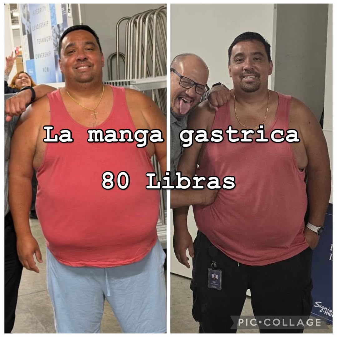 Instagram post by Dr. Michael P. Choi: 80 lbs down with gastric sleeve