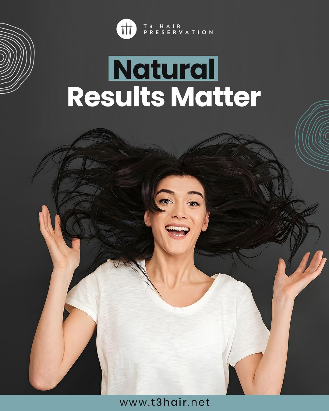 Instagram post by Dr. Michael S. Beckenstein: Hair restoration should never look artificial. At T3 Hair Preservation, treatments are designed to match your natural hairline, density, and…