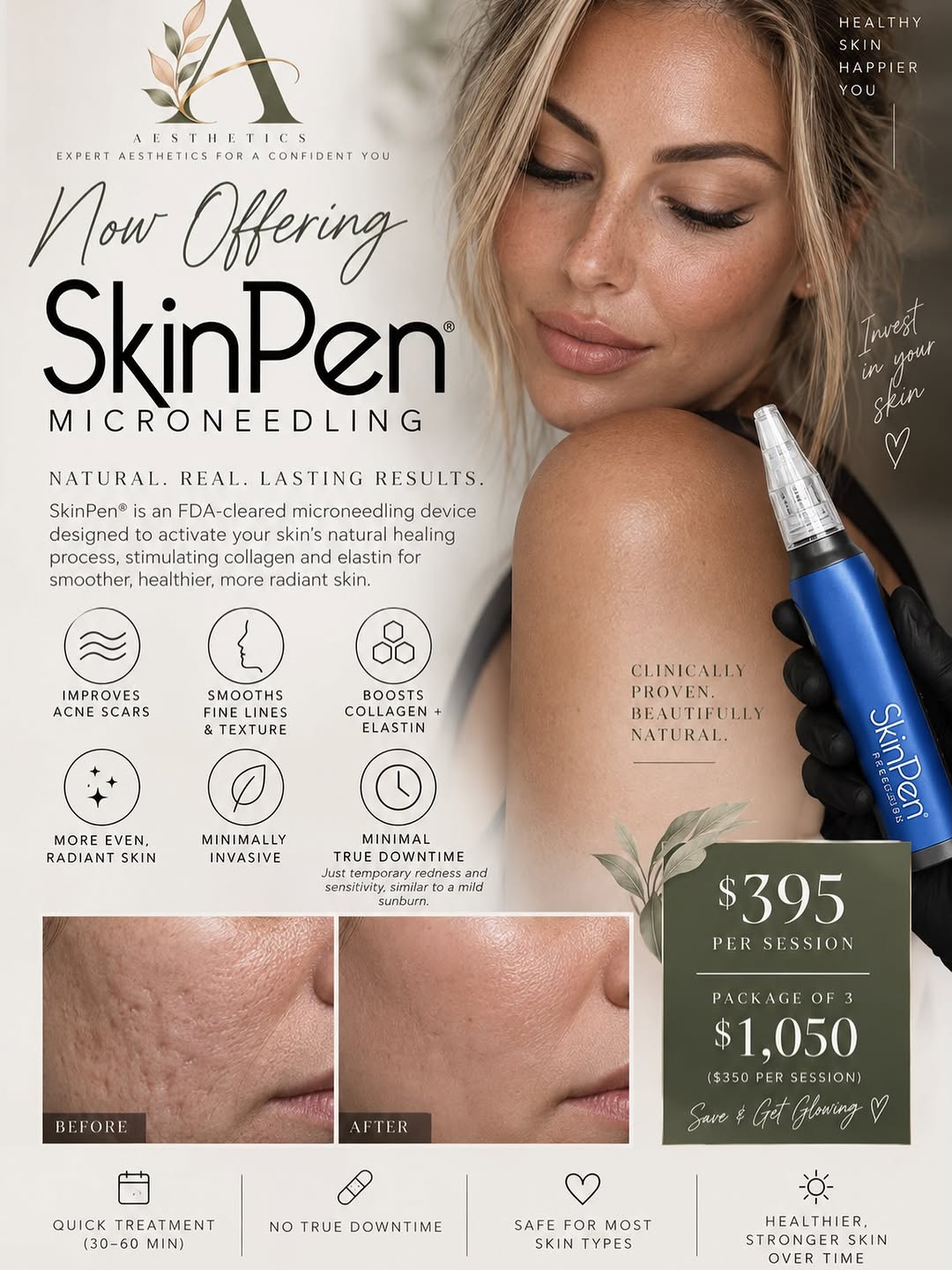 Instagram post by Dr. Michalynn Farley: ✨ NOW OFFERING SKINPEN® MICRONEEDLING ✨ Your skin’s new favorite treatment has officially arrived. 🤍 SkinPen® is an FDA-cleared microneedli…