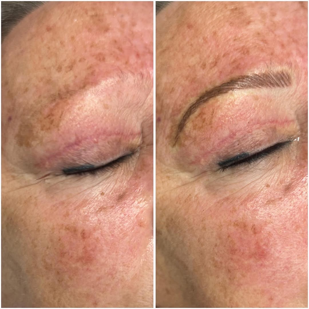 Instagram post by Dr. Michel C. Samson: Struggling with gift ideas for mom, aunt, girlfriend, wife or friends? Get them a gift certificate for microblading and they can enjoy the b…
