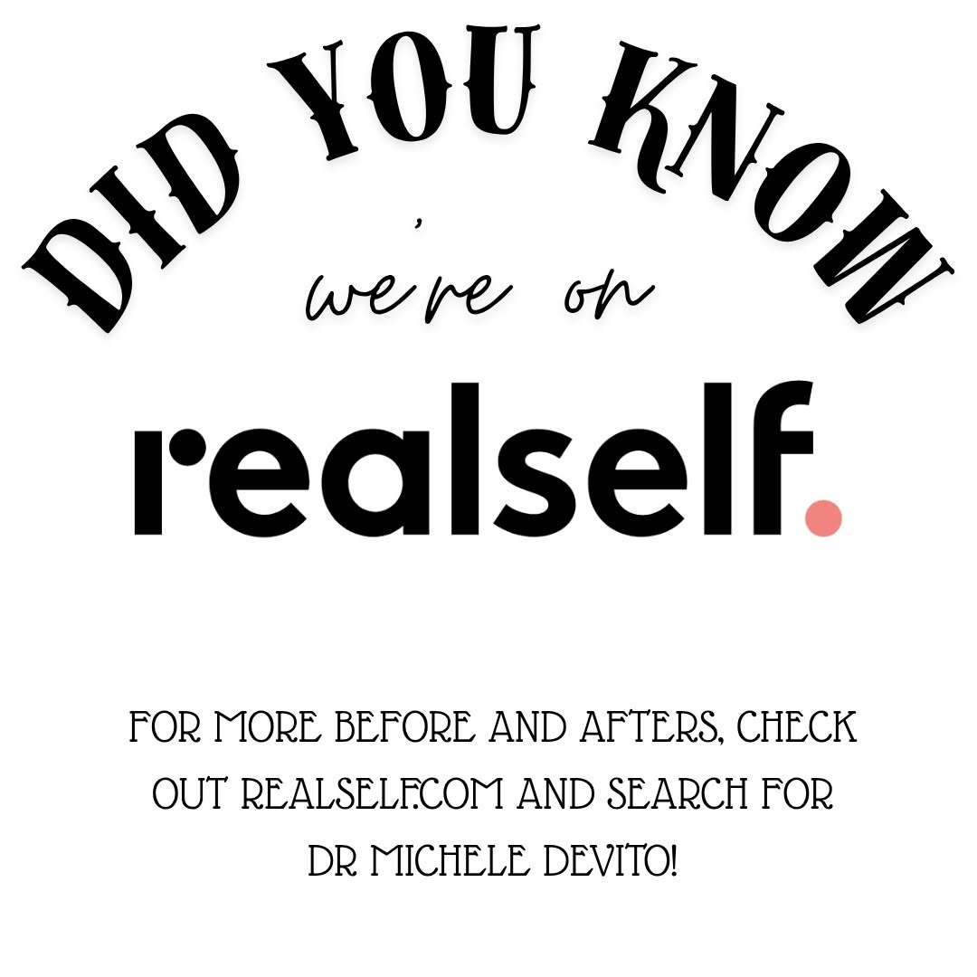 Instagram post by Dr. Michele DeVito: Check realself.com to see the best #before and #after #photos ! #plasticsurgeon #plastics #surgeon #scottsdale #labiaplasty #breastaugmentat…