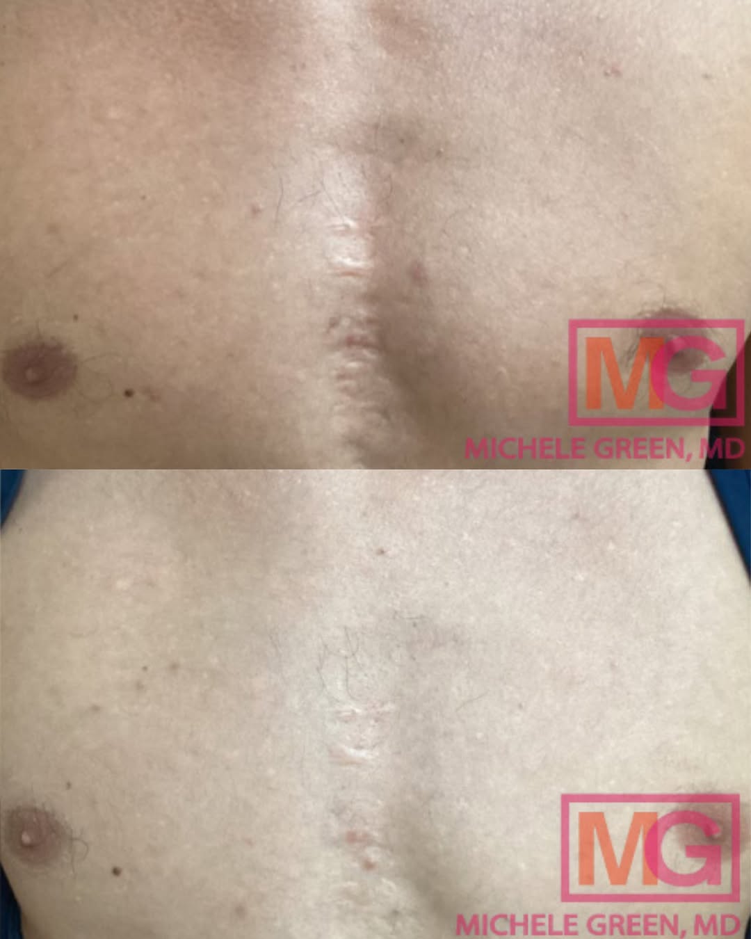 Instagram post by Dr. Michele S. Green: Before & After If you feel like you’re showing your age prematurely or you’re struggling with a troubled complexion or other skin care issue…