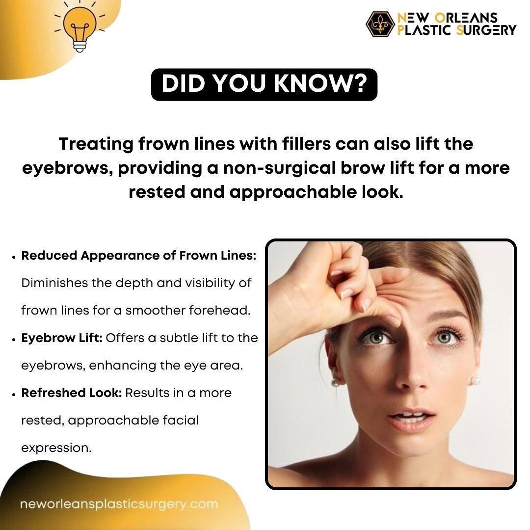 Instagram post by Dr. Michelle Eagan: Did you know? Treating frown lines with fillers can also lift the eyebrows, providing a non-surgical brow lift for a more rested and approac…