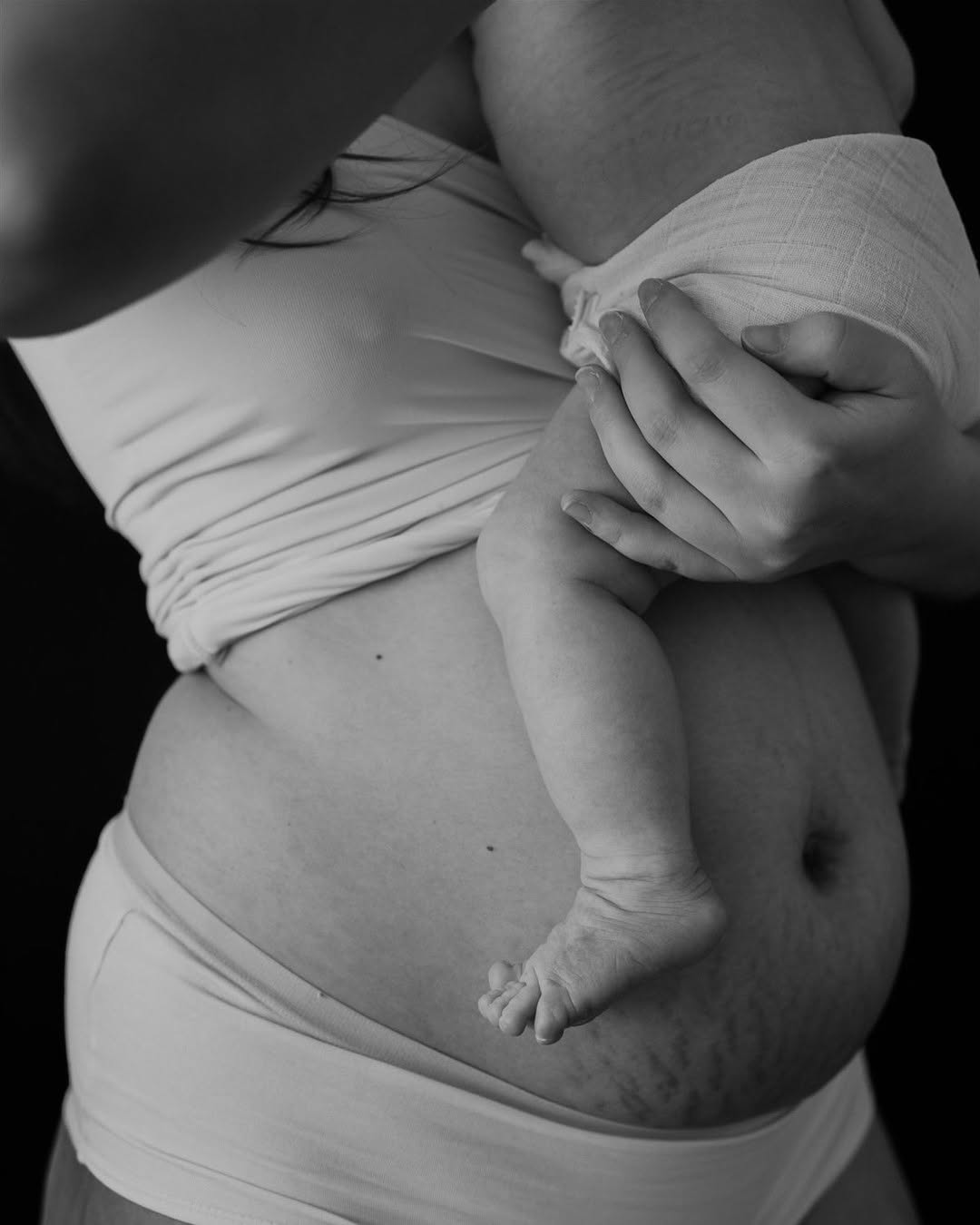 Instagram post by Dr. Miguel Delgado: Motherhood is beautiful, but it can sometimes change how you feel about yourself and your body. That's completely normal, and you're not alo…