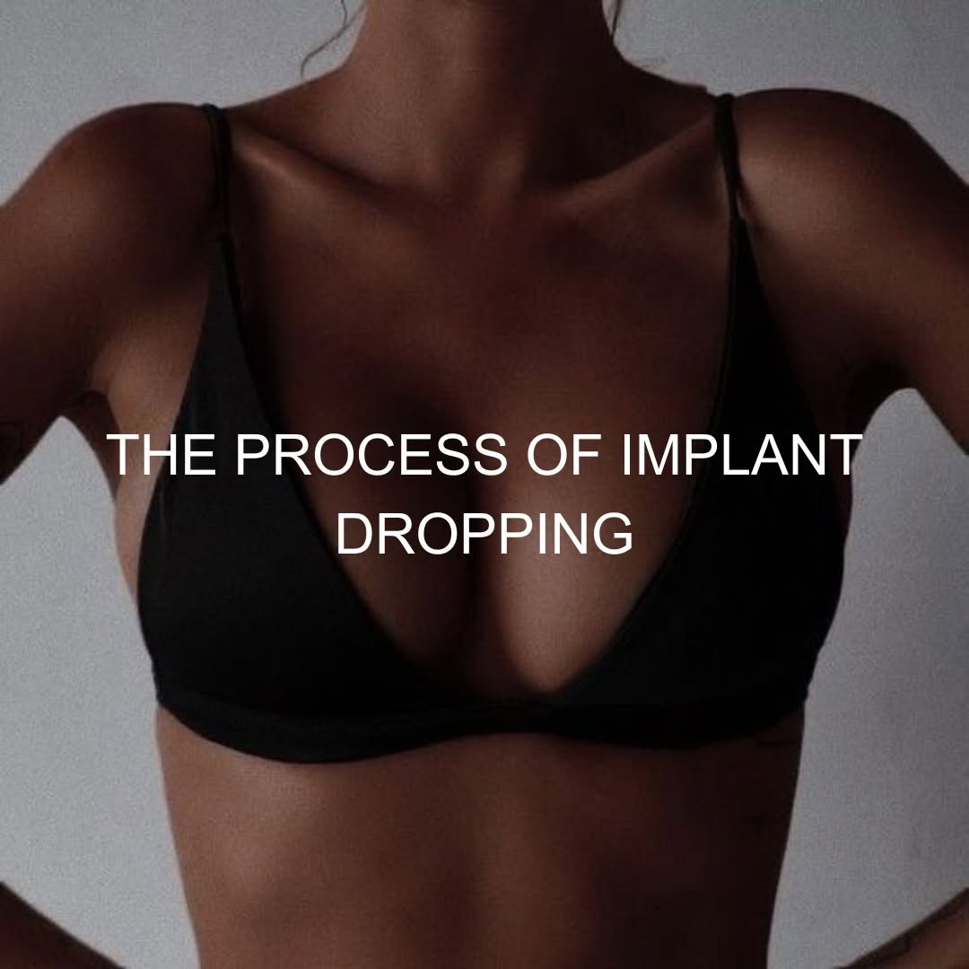 Instagram post by Dr. Mike E. Gonce: PSA‼️ - 156 days until the first day of summer!!☀️🌊 Remember that your body needs time to heal after any surgical procedure, and breast aug…