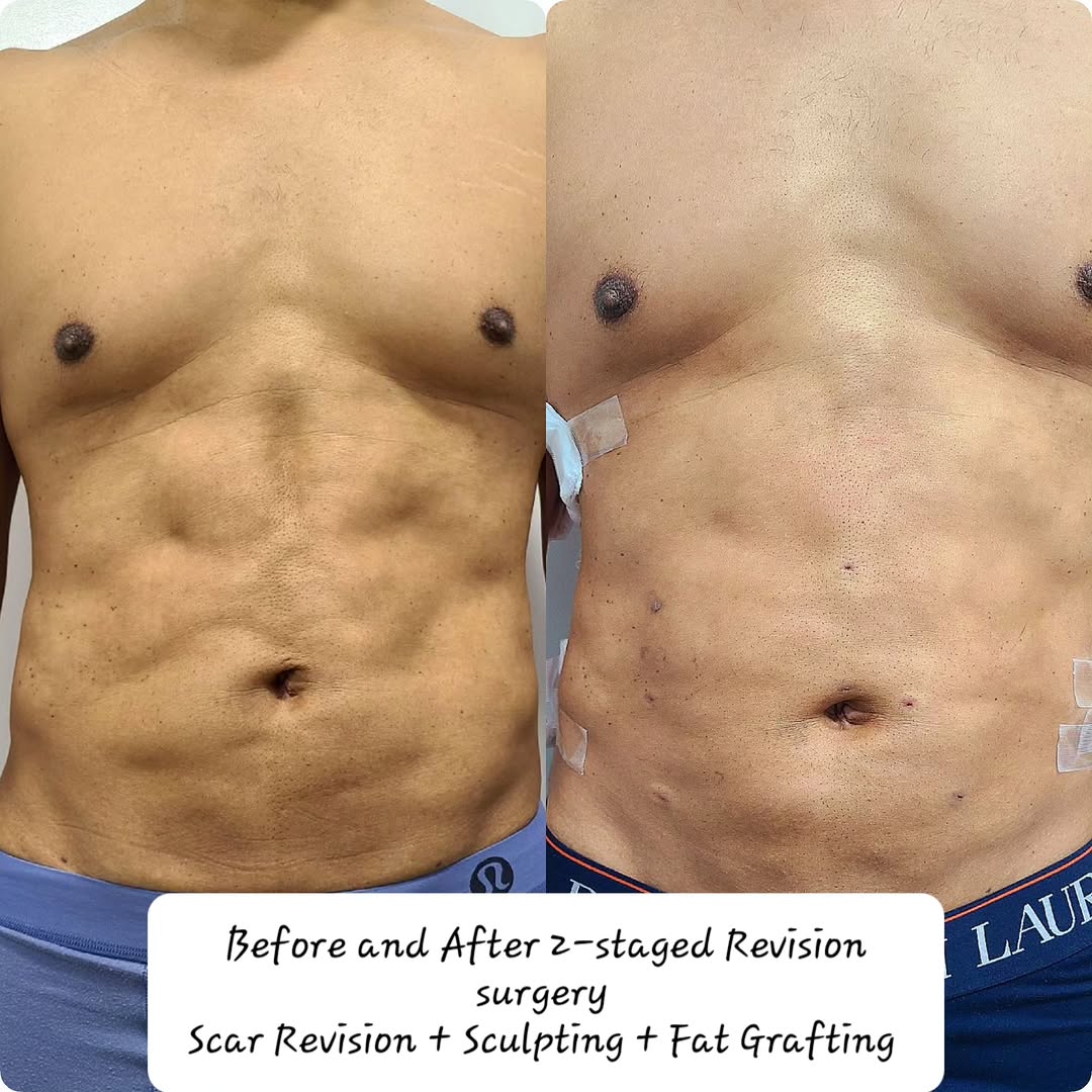 Instagram post by Dr. Misbah Khan: Creativity at its highest level is at the heart of all Revision Surgeries. These defects were >10 yrs old. The longer the problem lingers on…