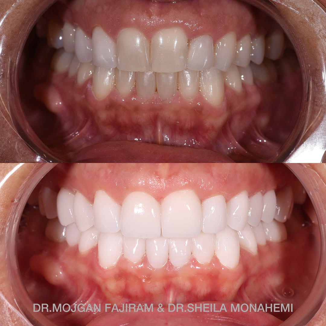 Instagram post by Dr. Mojgan Fajiram, DDS: Be kind 🙏life is better when you #smile 🤩😁