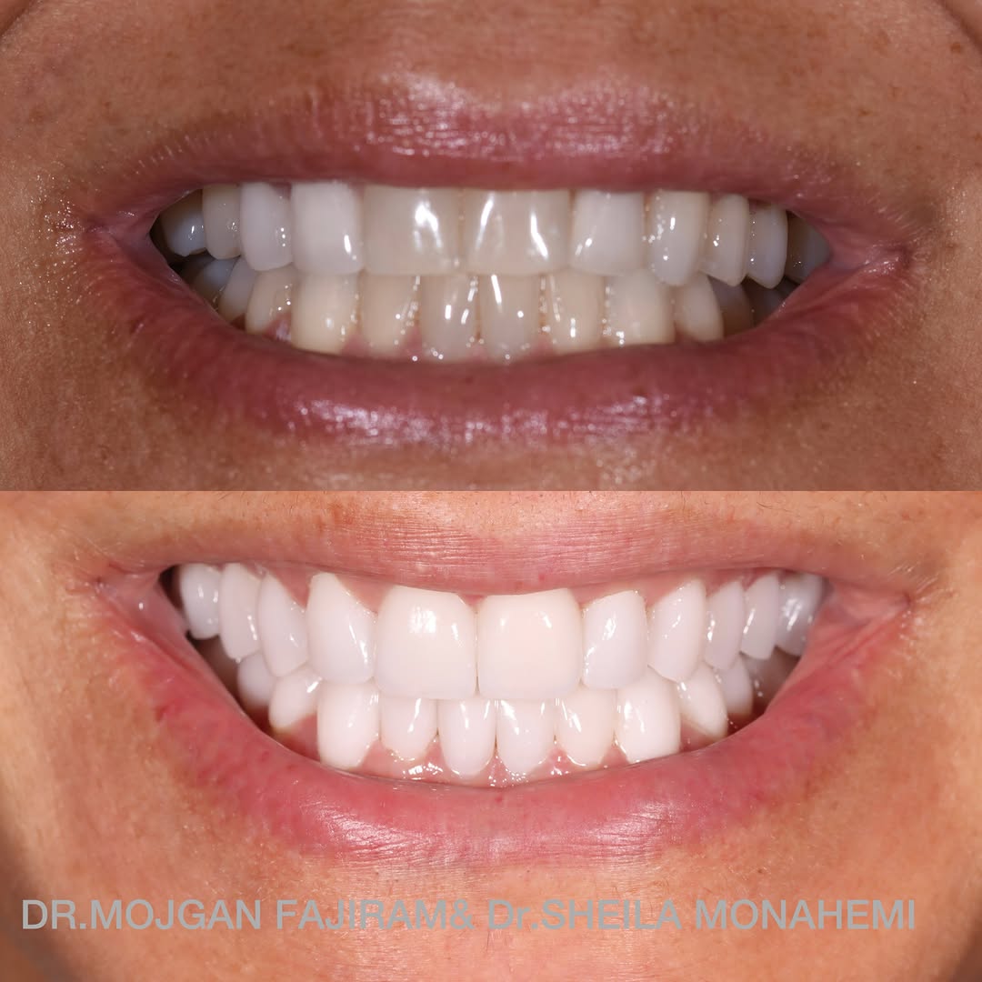Instagram post by Dr. Mojgan Fajiram, DDS: WHO IS NEXT? 😁😁😁🌟🌟🌟