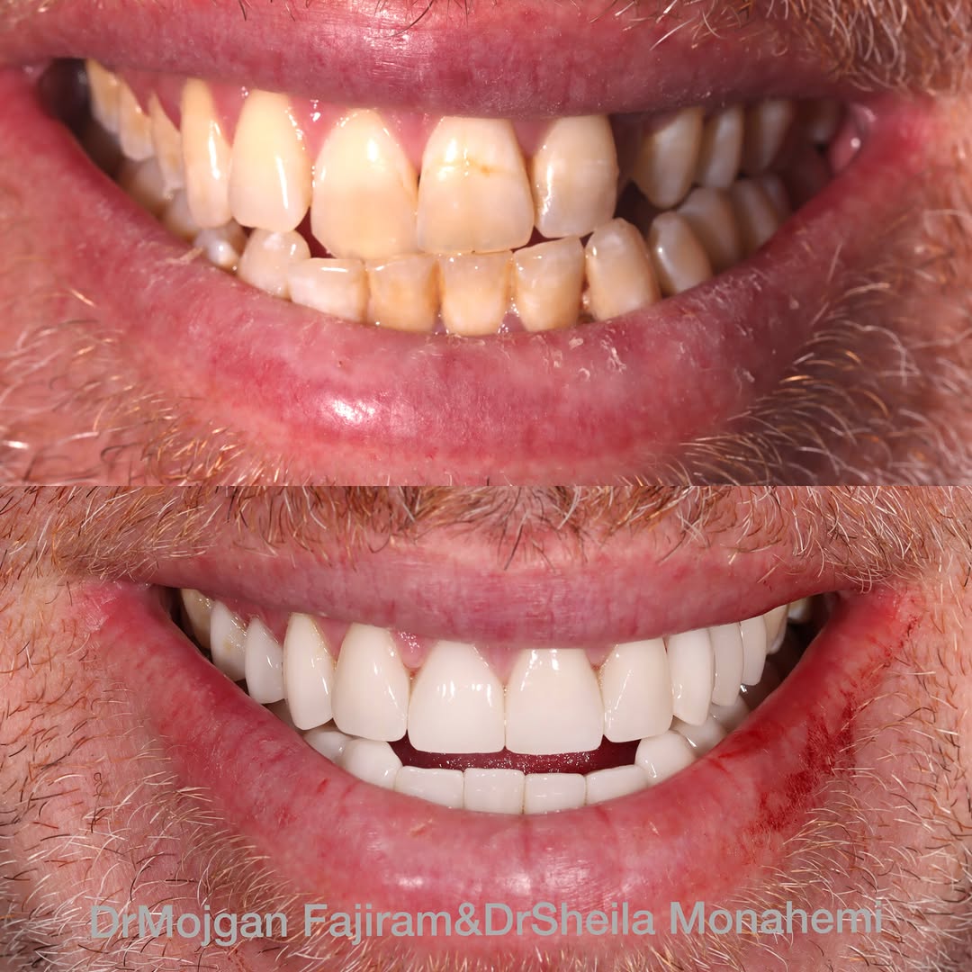Instagram post by Dr. Mojgan Fajiram, DDS: Working 9-5 to bring more smiles 😁