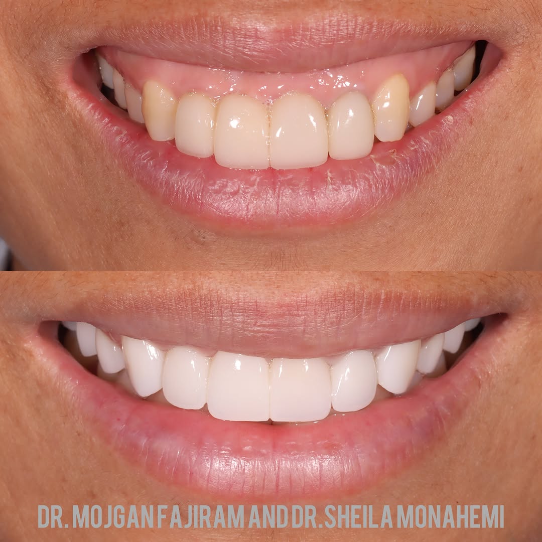 Instagram post by Dr. Mojgan Fajiram, DDS: Light, camera, SMILE 😁😁🤩