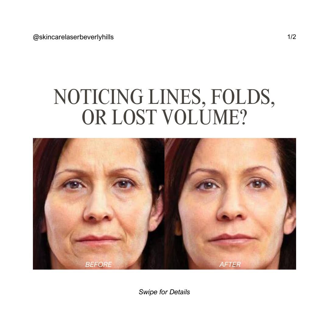 Instagram post by Dr. Naissan Wesley: Lines, folds, lost volume — they don’t have to define your reflection. Our physician-led treatments are designed to restore balance, smooth …