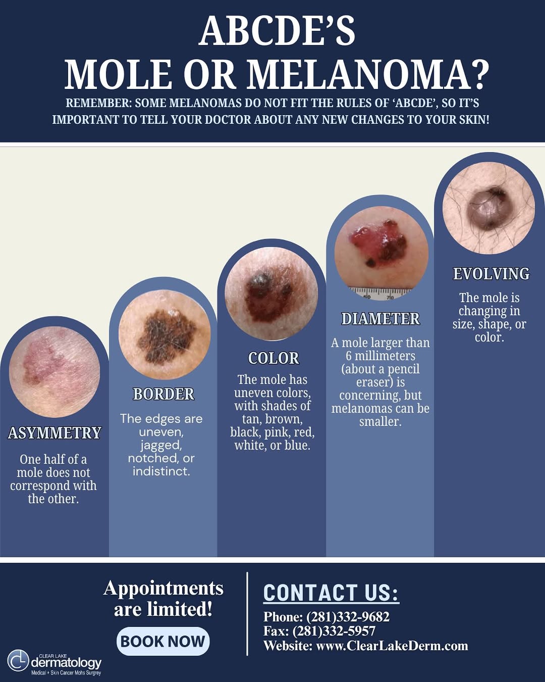 Instagram post by Dr. Narin (Joe) Apisarnthanarax: Spot the signs early with the ABCDE’s of melanoma 🔍 Use the ABCDE rule to help identify signs of melanoma: 🔹 Asymmetry 🔹 Border irregular…