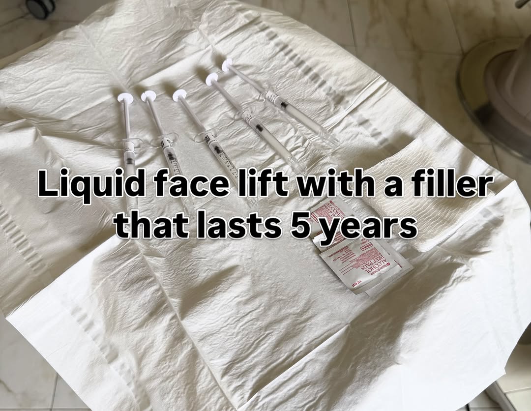 Instagram post by Dr. Natalie Borodoker: @bellafill Filler that lasts. We are getting amazing natural results that do not disappear in 6 months! #filler #rejuvenation #naturalresult…