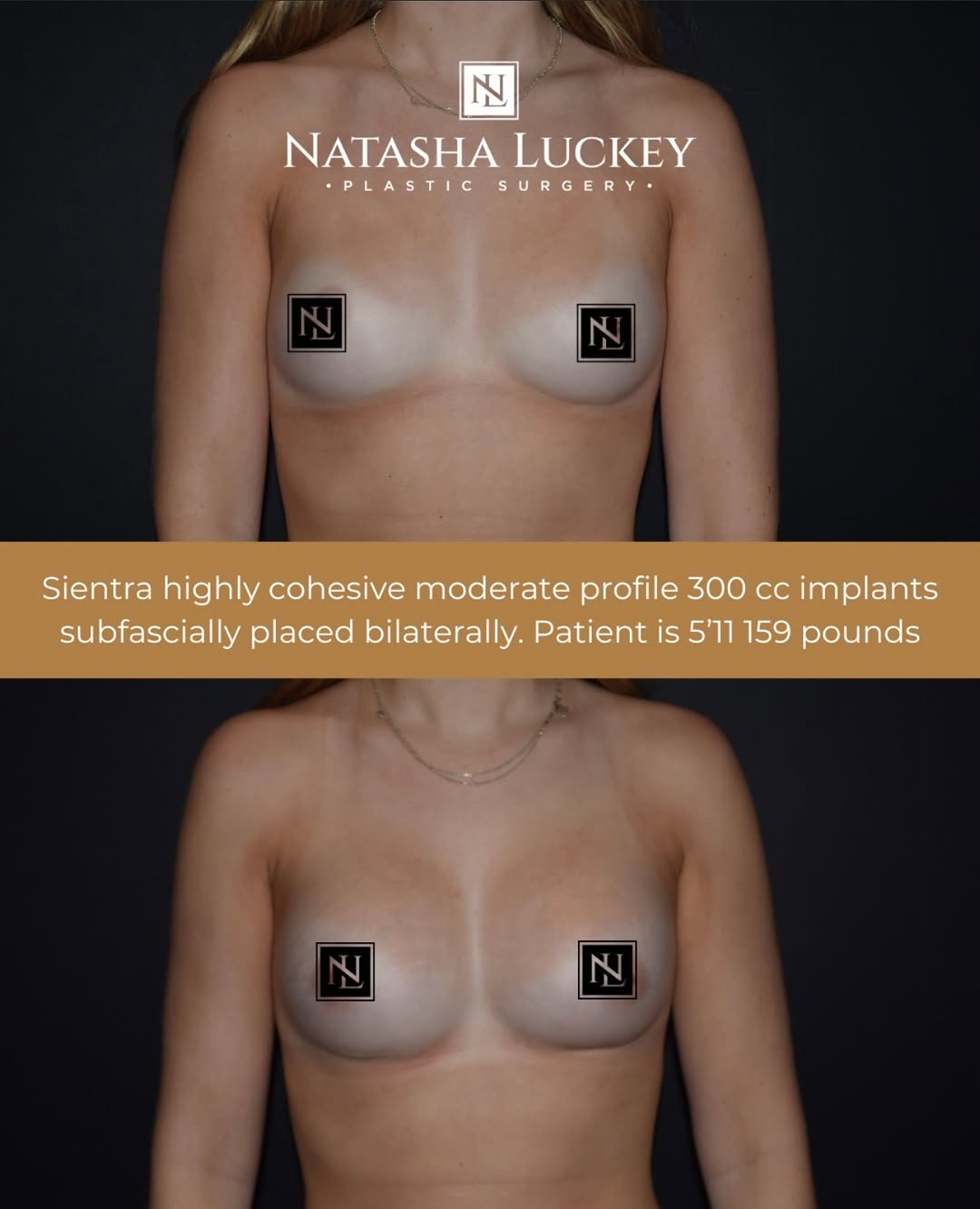 Instagram post by Dr. Natasha Luckey: • If you’re going to do it, go to the best! • Dr. Natasha Luckey’s work speaks for itself! • Let’s make it happen and book your consultation…