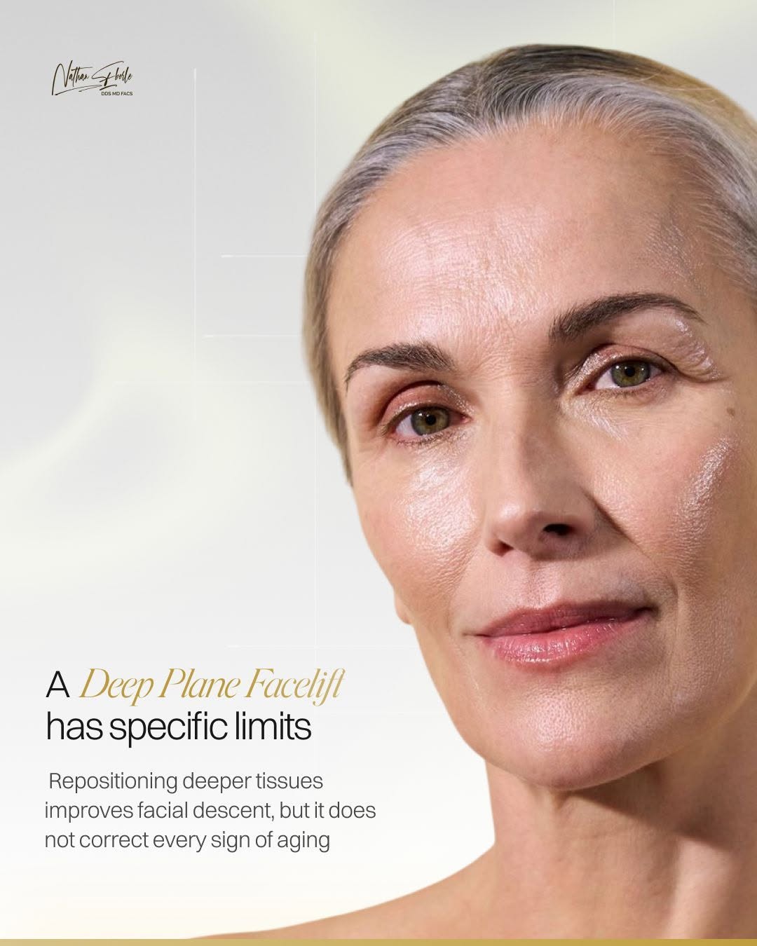 Instagram post by Dr. Nathan Eberle: A Deep Plane Facelift can reposition deeper facial tissues and restore support where aging has caused descent, but I also want my patients t…
