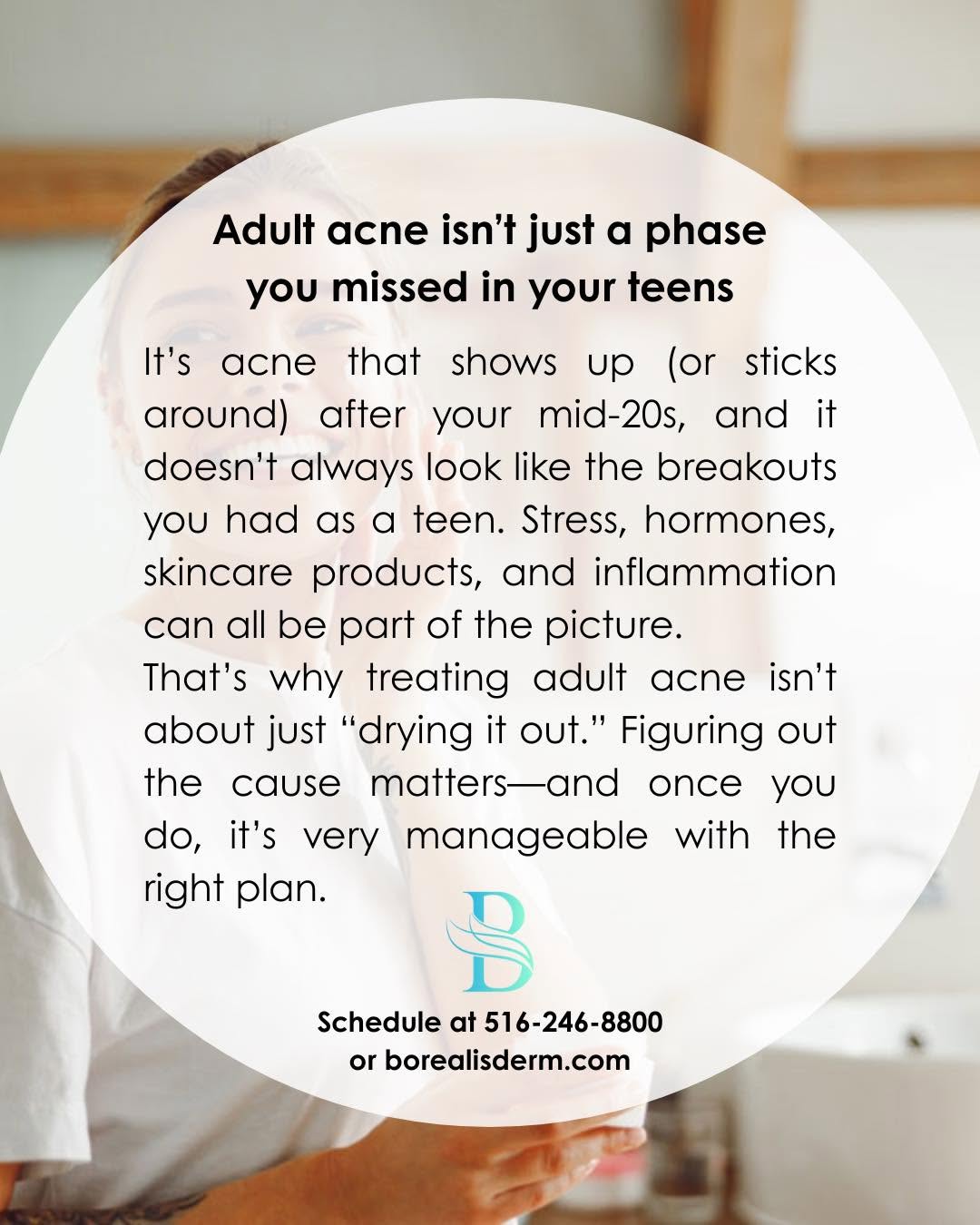 Instagram post by Dr. Navin S. Arora, DO, FAAD: Acne for adults… Call to schedule your acne visit now at 516-246-8800. #LongBeachNY #LongBeachNY #borealisderm #GlenCove #Hempstead #Merrick…