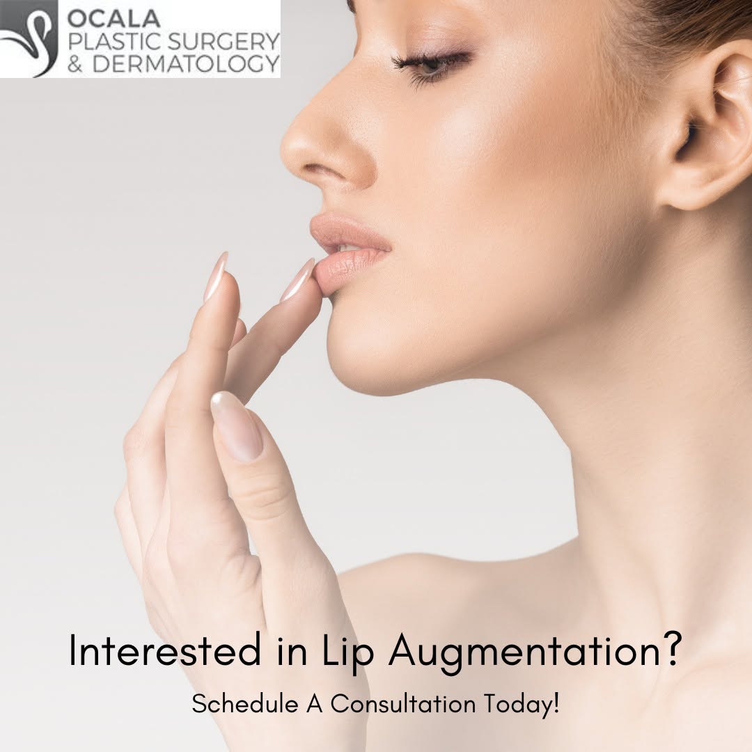 Instagram post by Dr. Navinderdeep S. Nijher: Lip augmentation creates fuller, plumper lips and reduces fine wrinkles around the mouth. Lips may be injected with injectable fillers such …