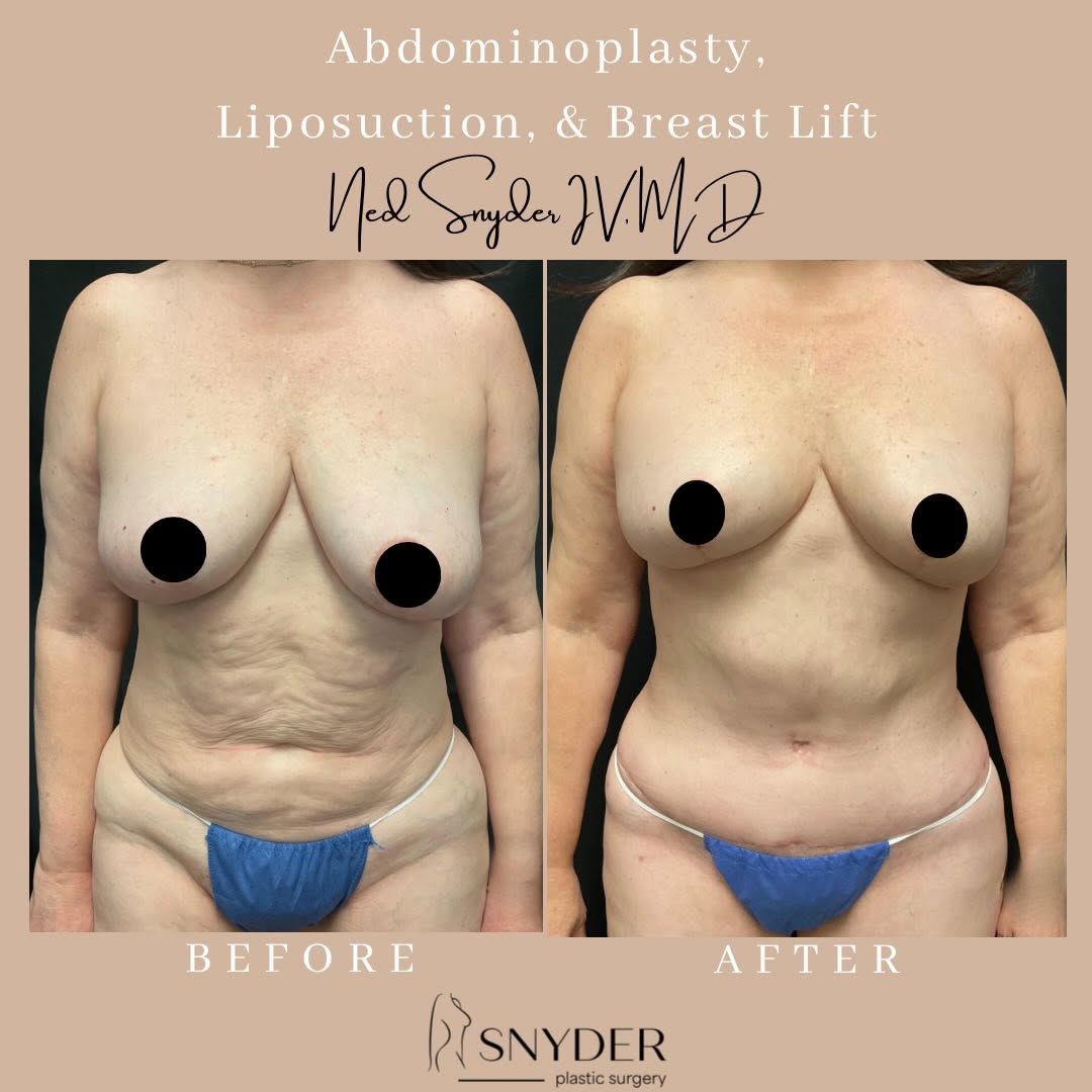 Instagram post by Dr. Ned Snyder, IV: What would feeling more confident in your own skin mean to you?🤩💓 This patient achieved a beautiful transformation with a customized combi…