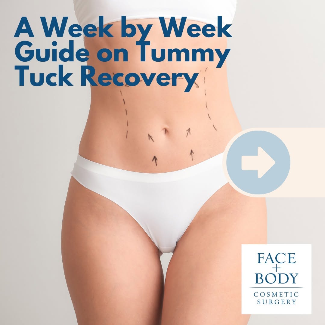 Instagram post by Dr. Nick Masri: One of the primary concerns of patients who undergo abdominoplasty is the time it takes to recover from the procedure. Many patients are wor…
