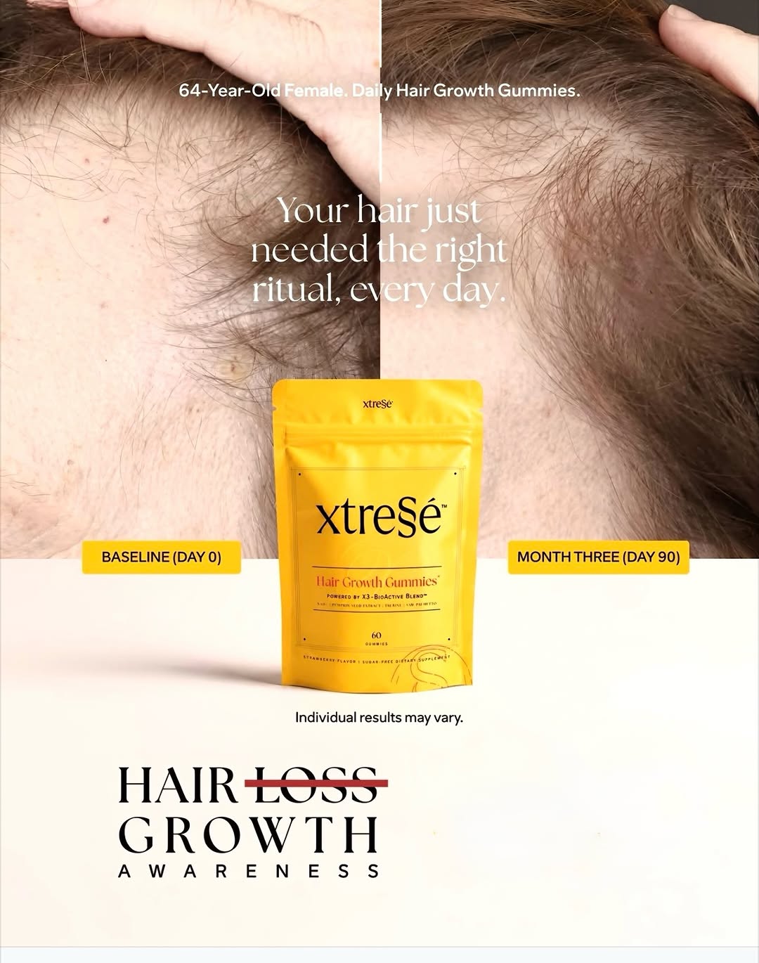 Instagram post by Dr. Nicole Castellese: Hair loss is complex and Xtressé is too. Xtressé is dermatologist-formulated to address the real drivers of hair loss because surface-level …