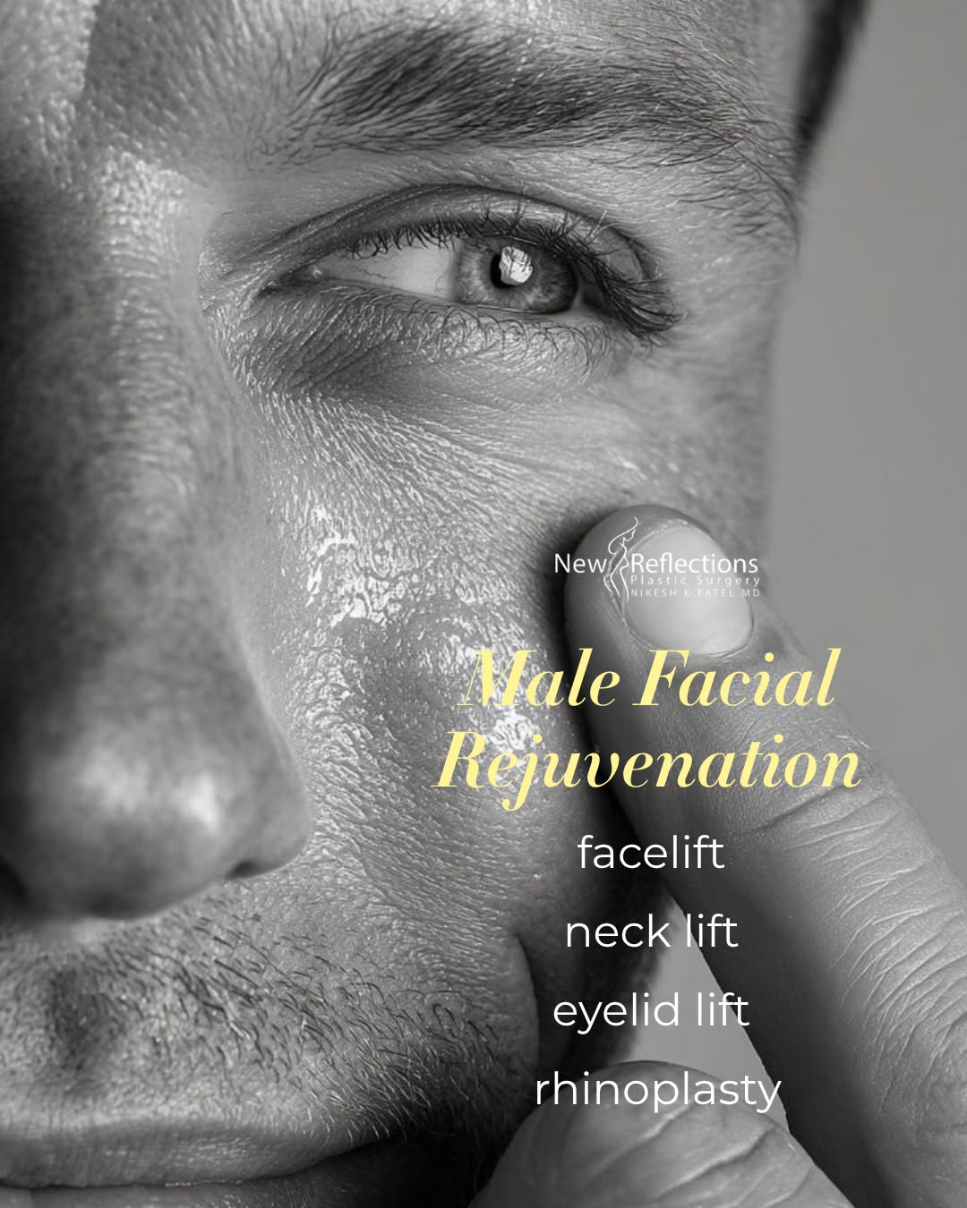Instagram post by Dr. Nikesh K. Patel: More men are choosing facial procedures to look refreshed, defined, and more like themselves without looking overdone.💆🏻‍♂️ From a facelif…