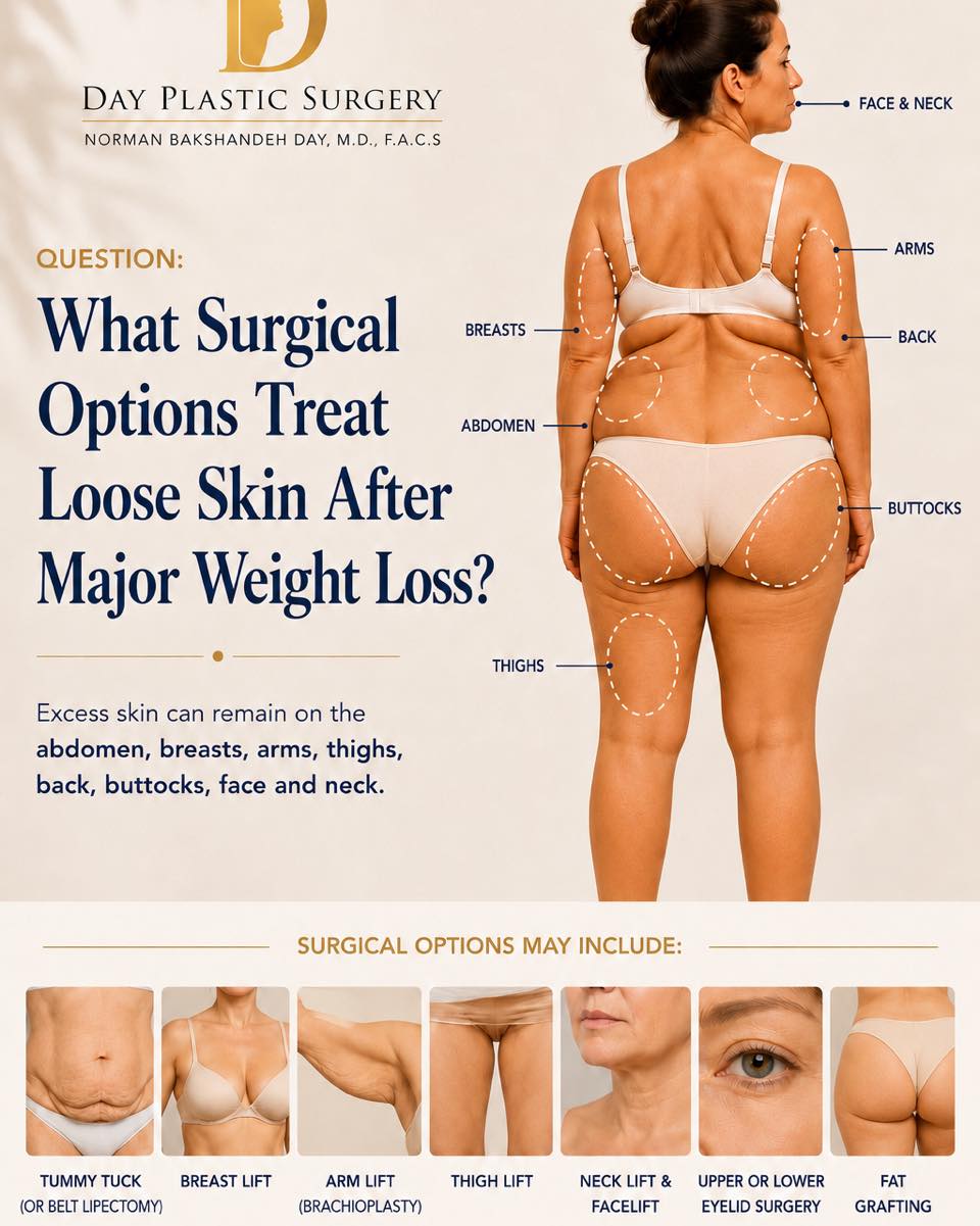 Instagram post by Dr. Norman Bakshandeh Day: After major weight loss, loose skin can remain. Surgical options can help restore shape, contour and confidence. Customized solutions. Natur…